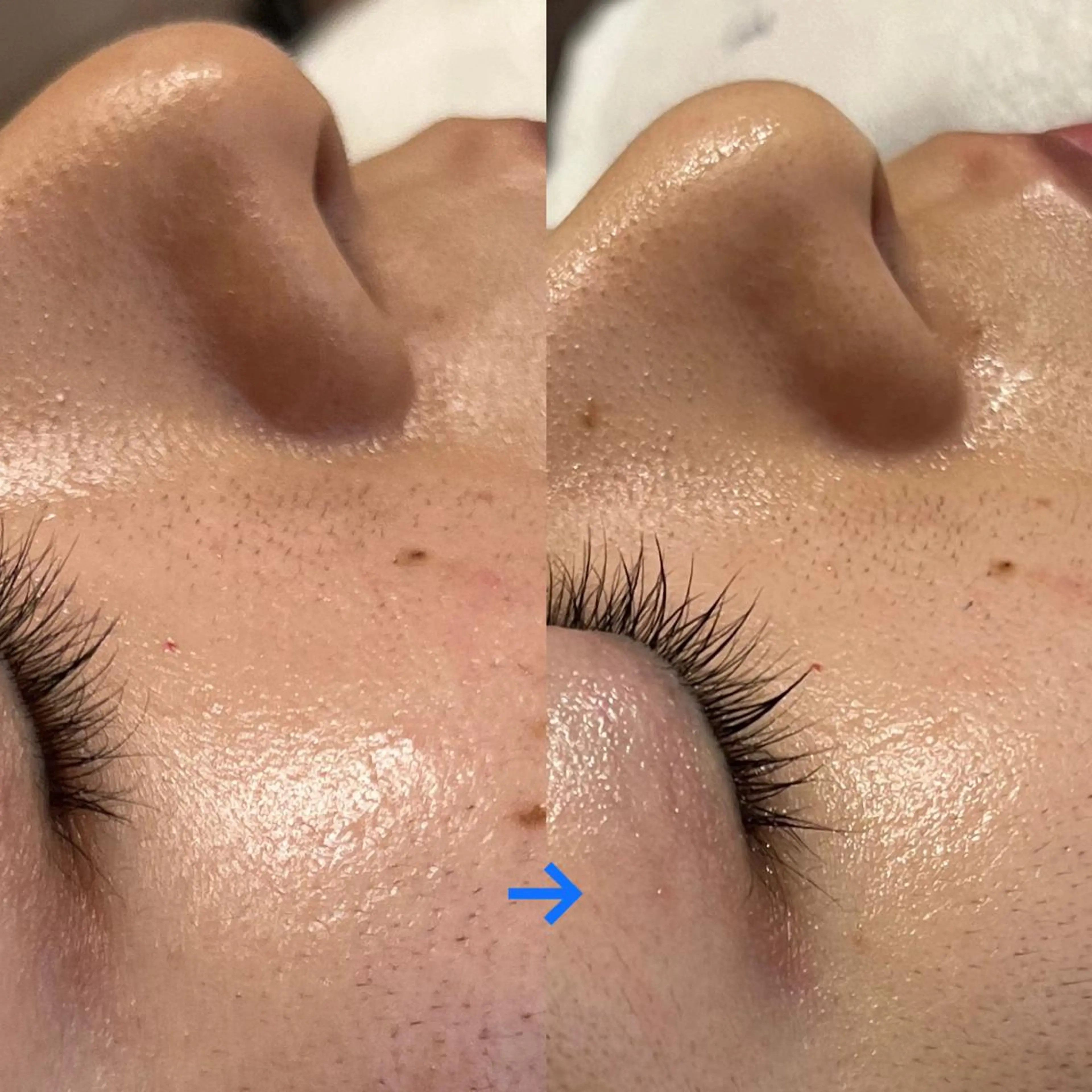 メナードフェイシャルサロン　リンガーデン所属・田中 友佳理のエステ・リラクイメージ