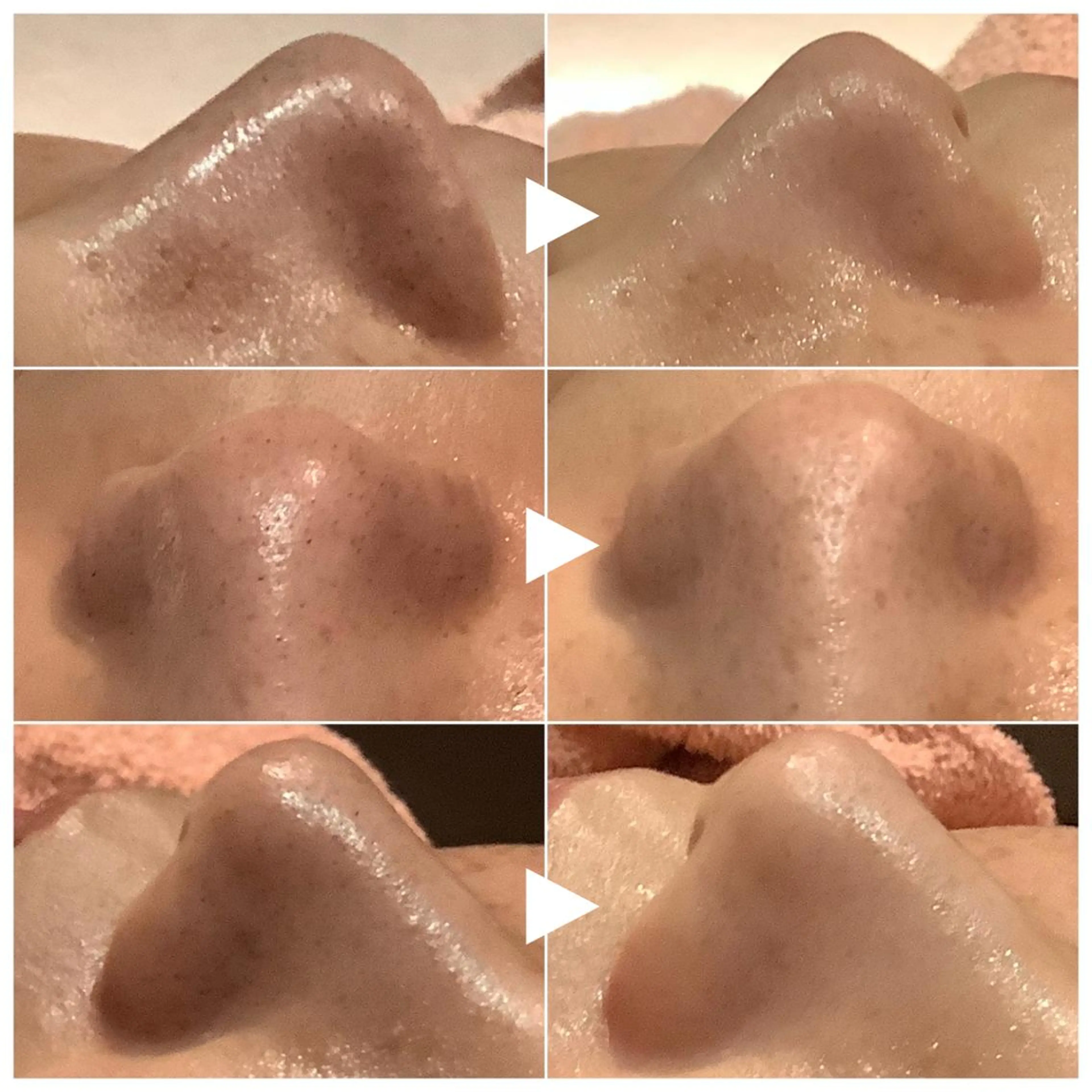 エステ 脱毛&エステサロン JIGGLY武蔵小山のエステ・リラクイメージ