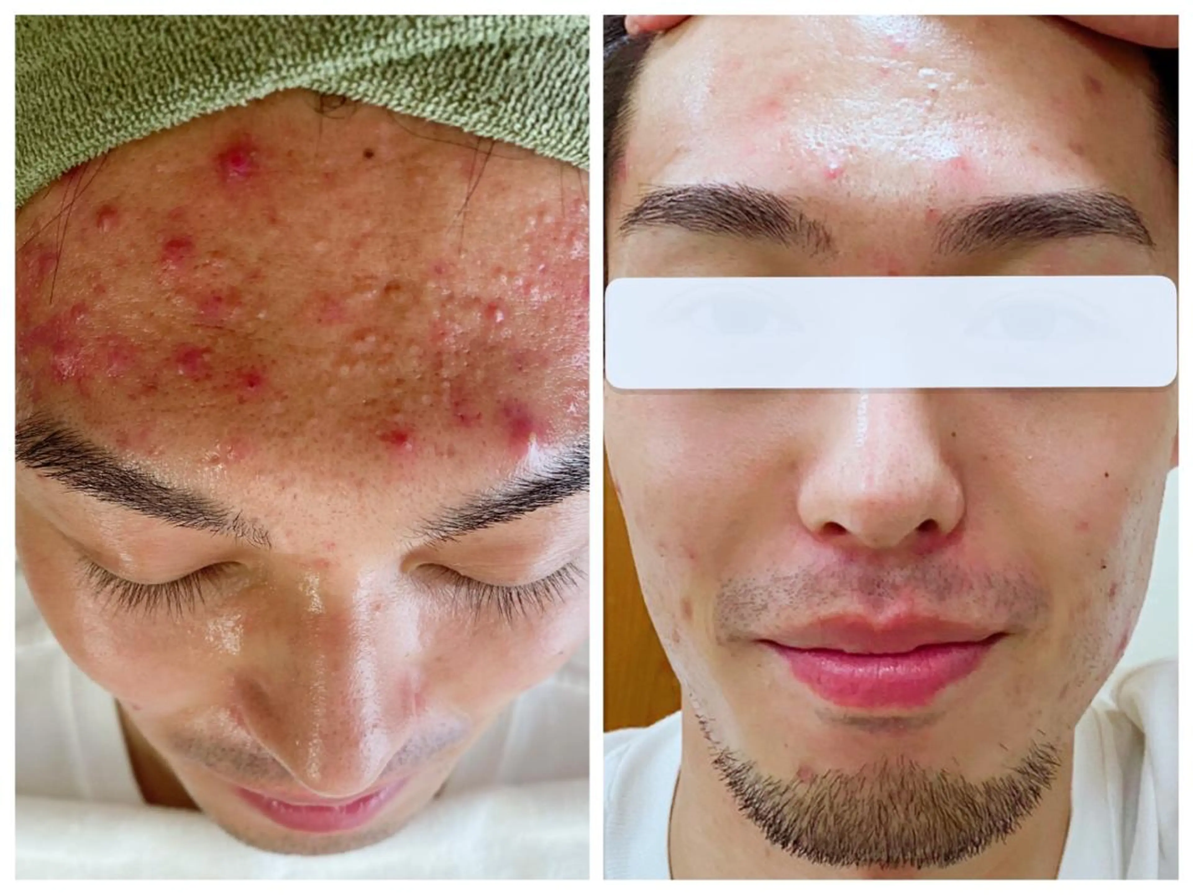 Brand byme 上野店のエステ・リラクイメージ