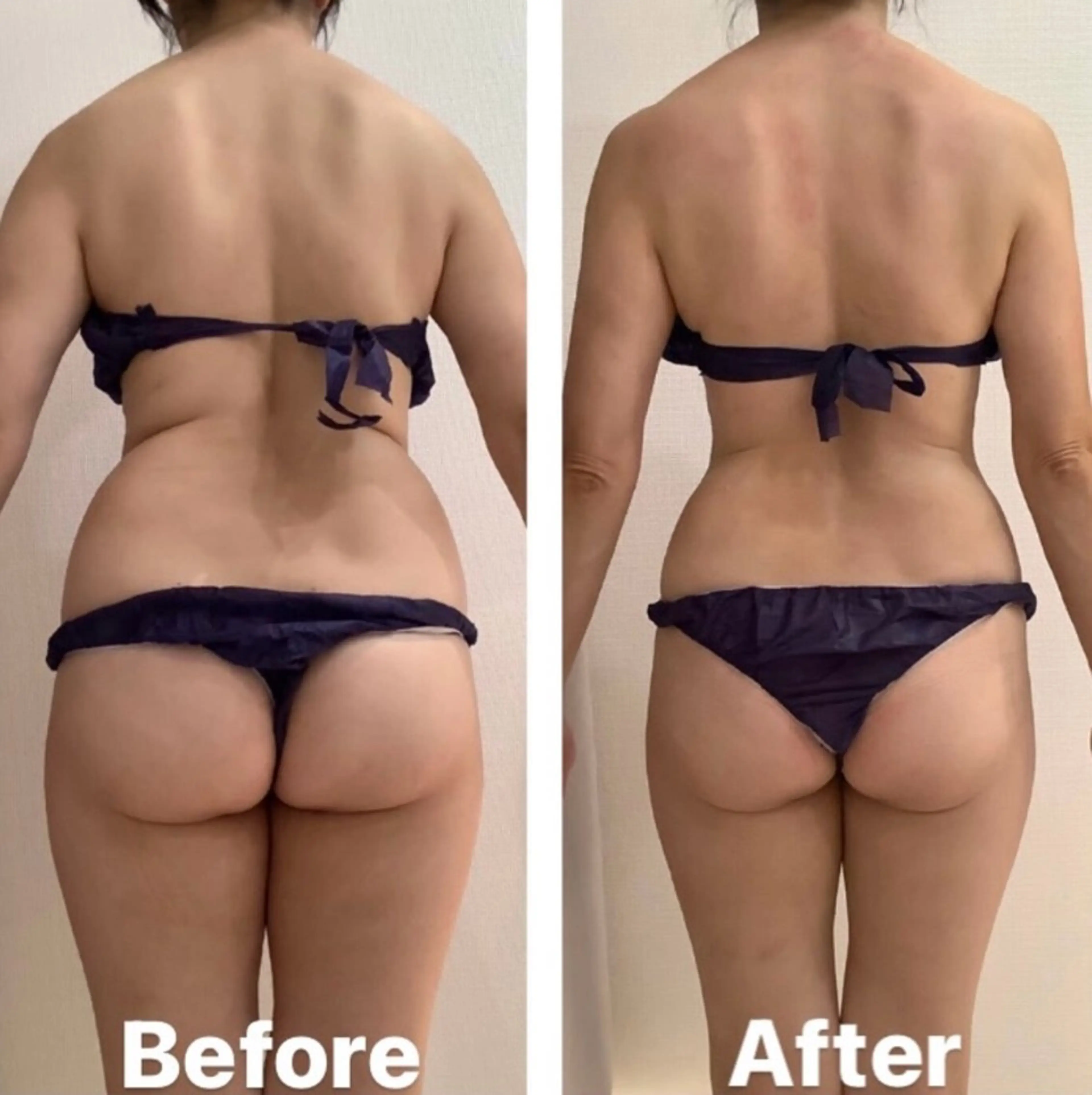 【スピード痩身NO.1】頑固なセル脂肪にも！4D痩身+リンパマッサージの写真