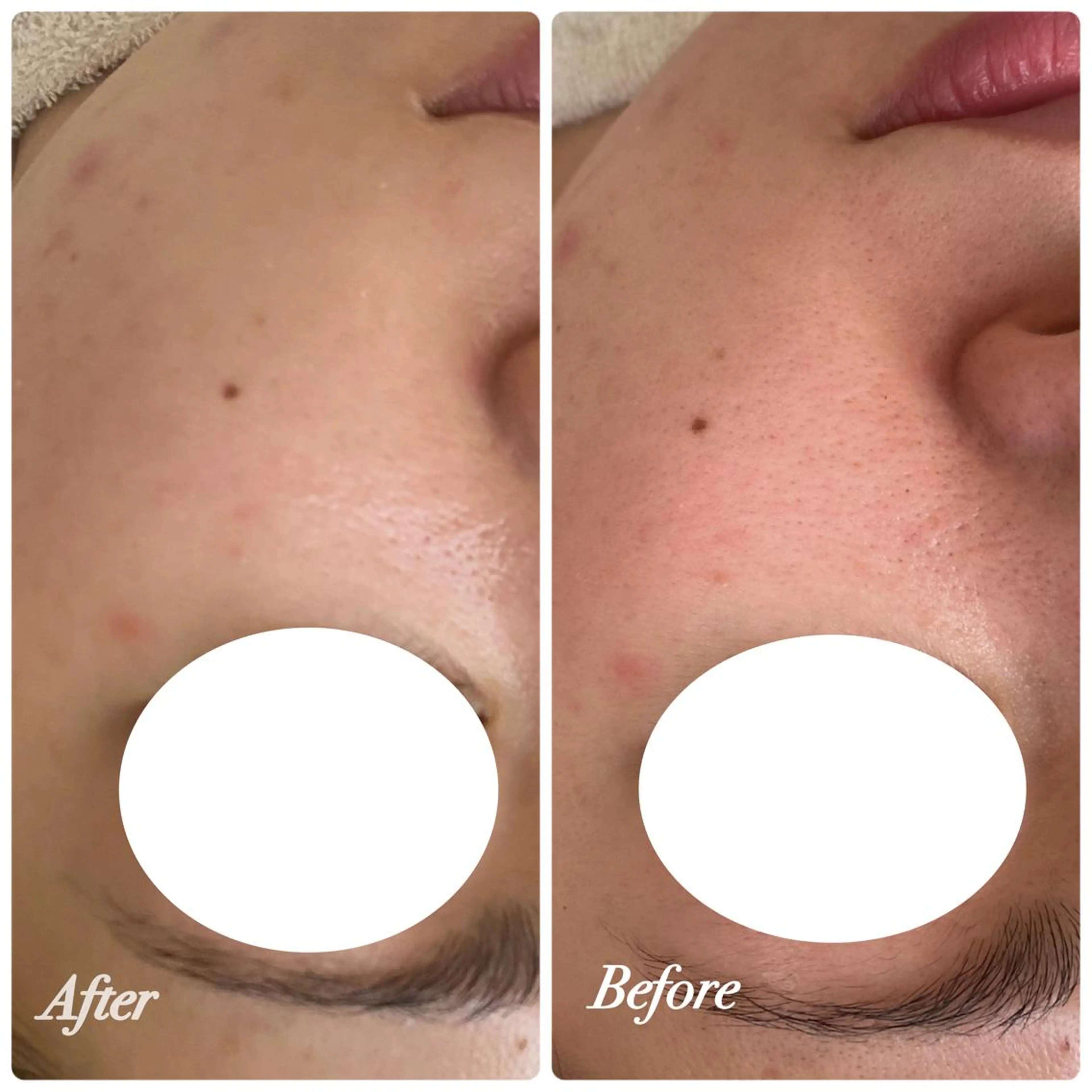 ネイル エステ リラク Private salon Dux所属・肌管理&nail Salon  Duxの眉毛・アイブロウイメージ