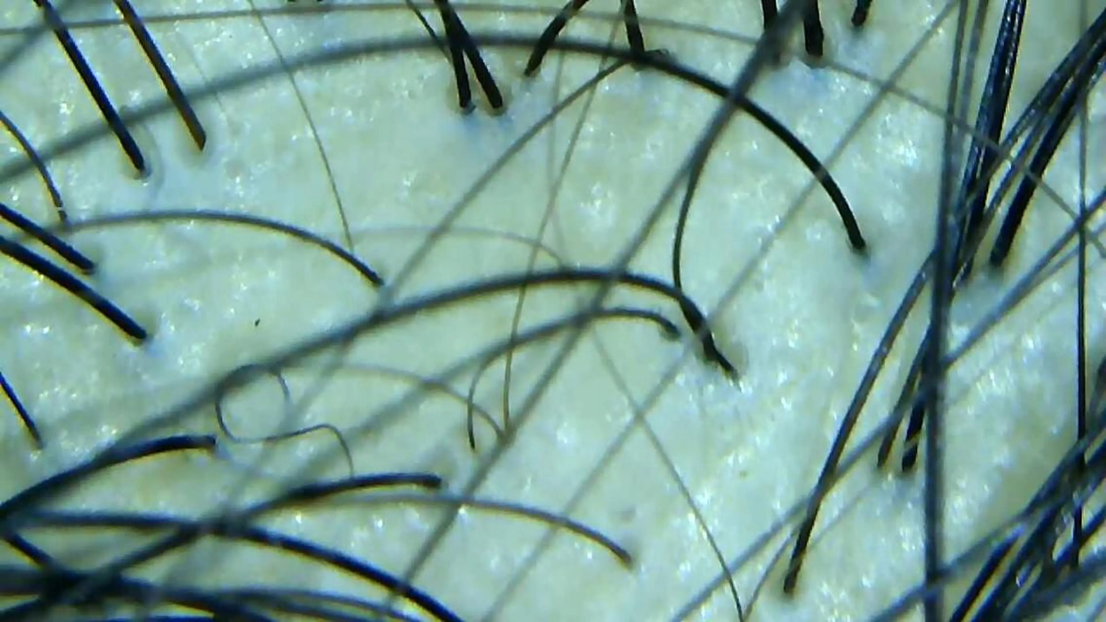 セントラル鍼灸院 Re:laxyのエステ・リラクイメージ