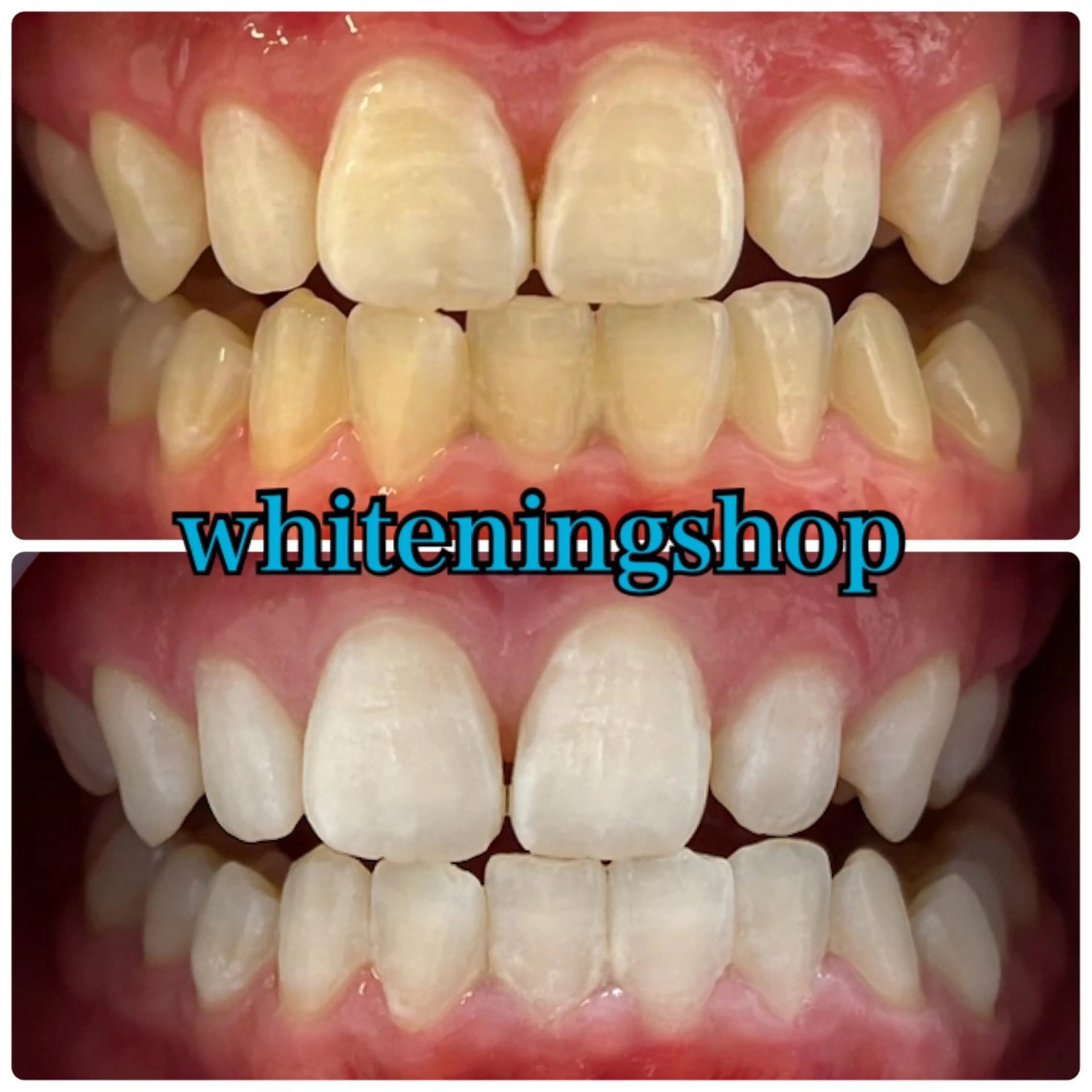 エステ リラク ホワイトニング ショップ吉祥寺店のエステ・リラクイメージ