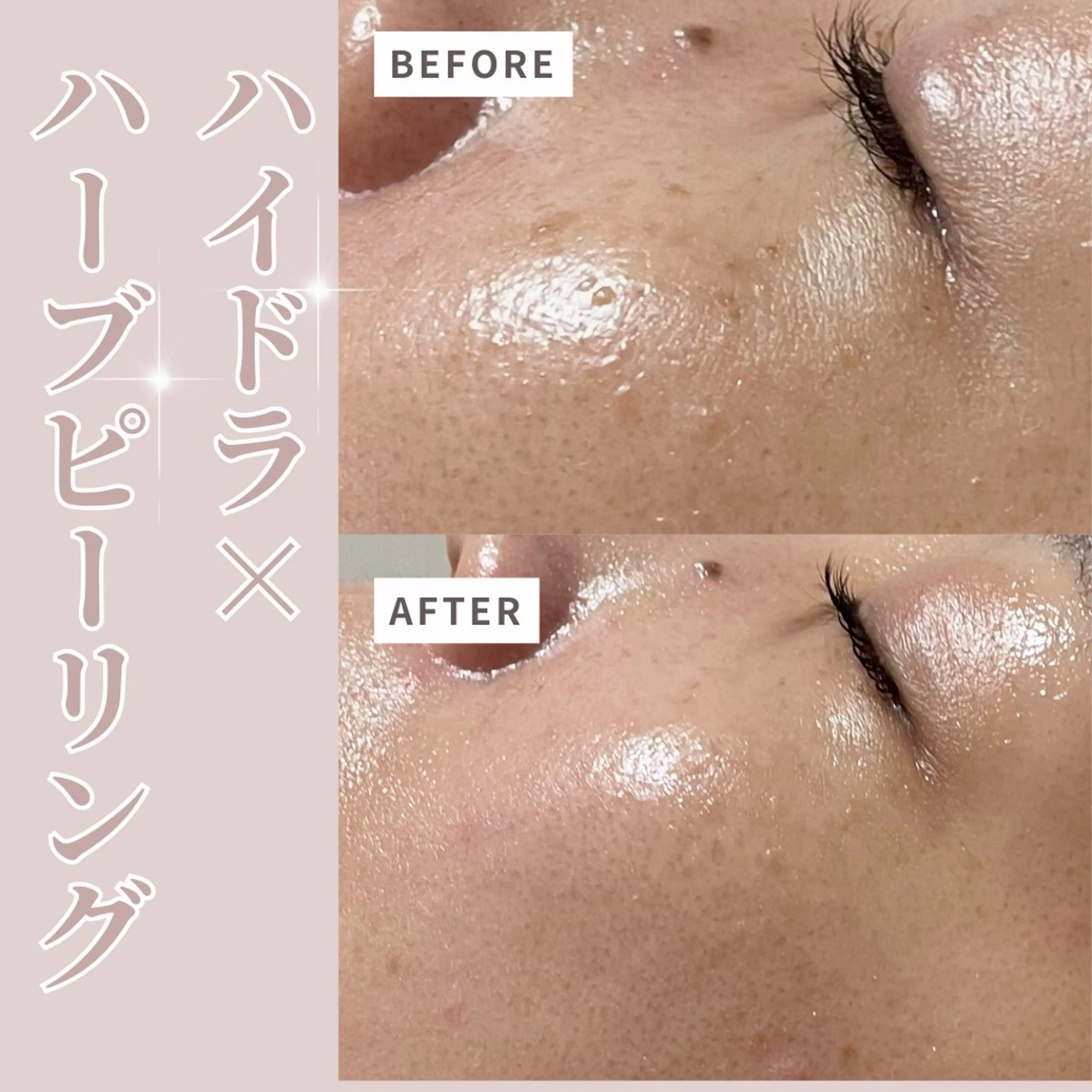 エステ プライベートサロン Belle（ベル）のエステ・リラクイメージ