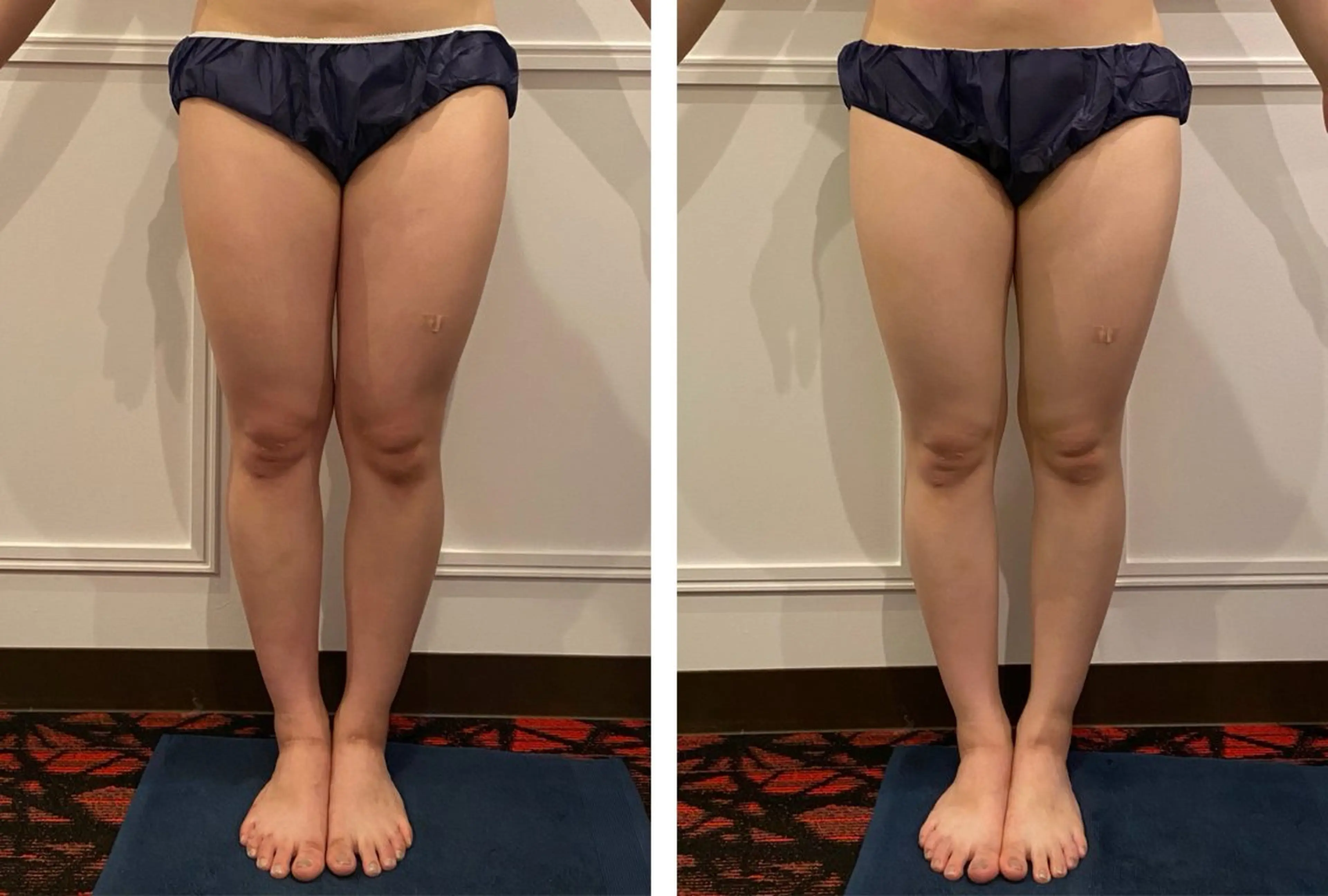 ハイパーナイフEX 小顔×痩身ケアのエステ・リラクイメージ