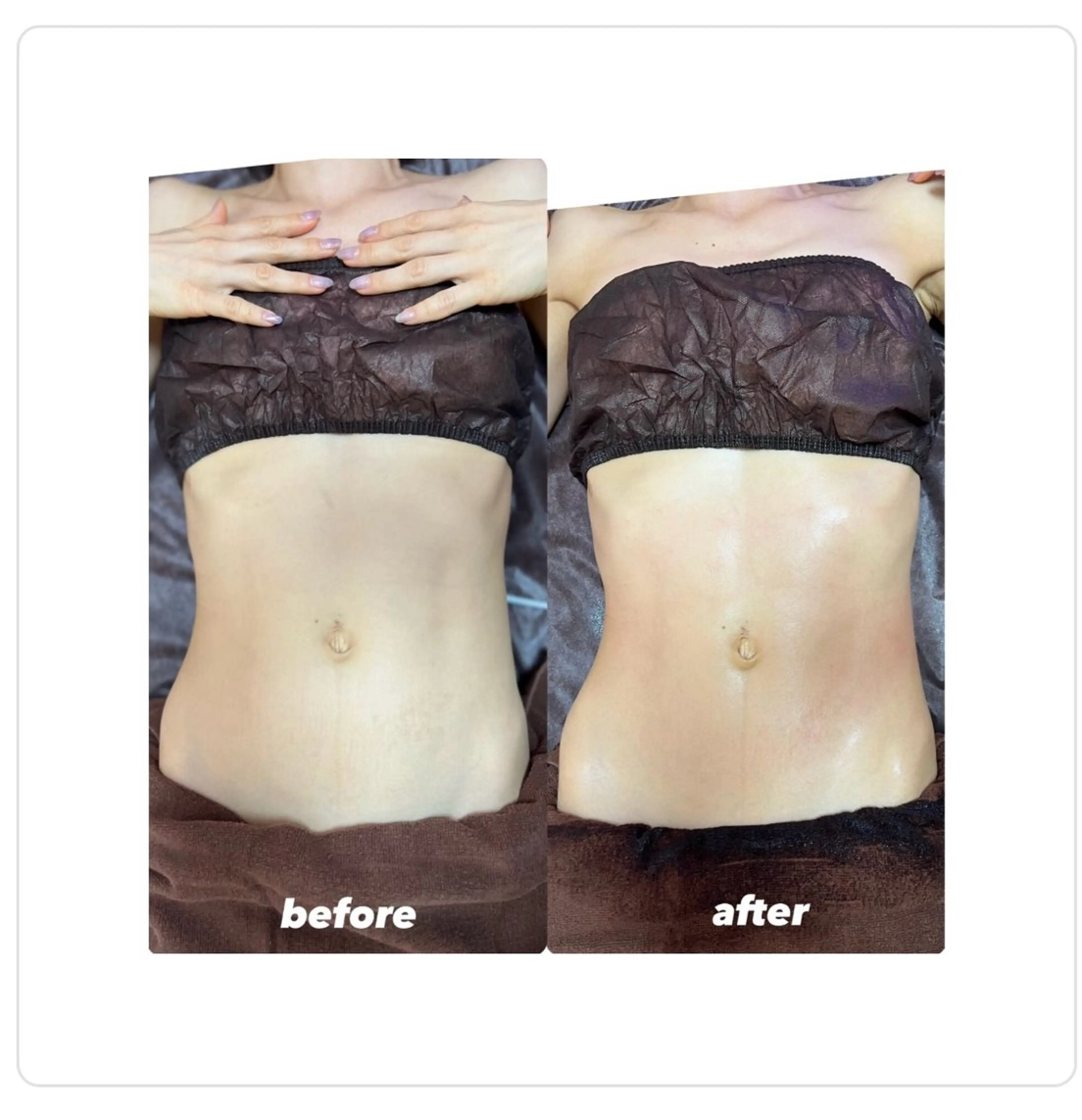 エステ 桐山 まどかのその他イメージ