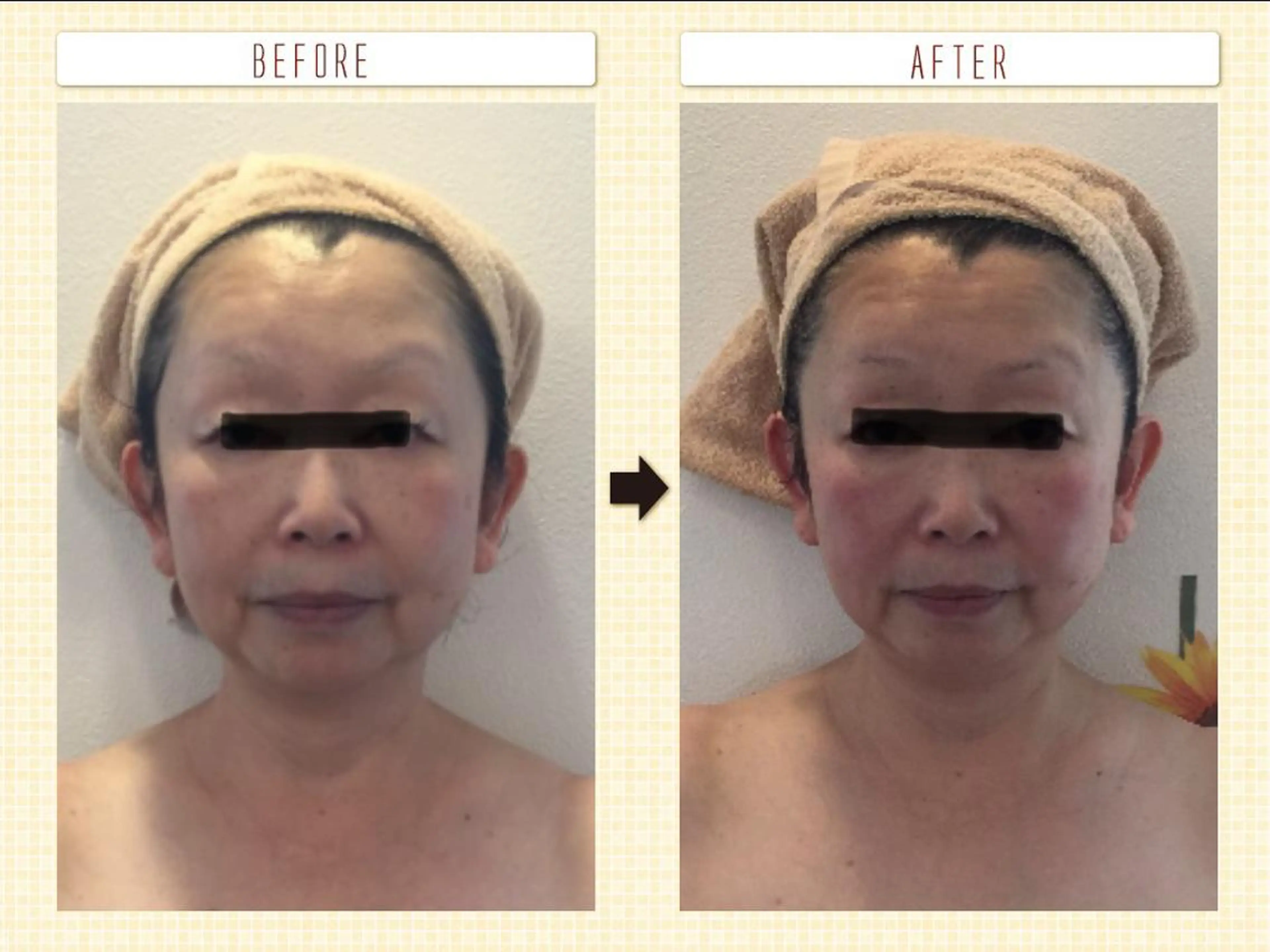 エステ Lipula リプラ所属・毛穴ツヤ肌専門    Lipulaのエステ・リラクイメージ