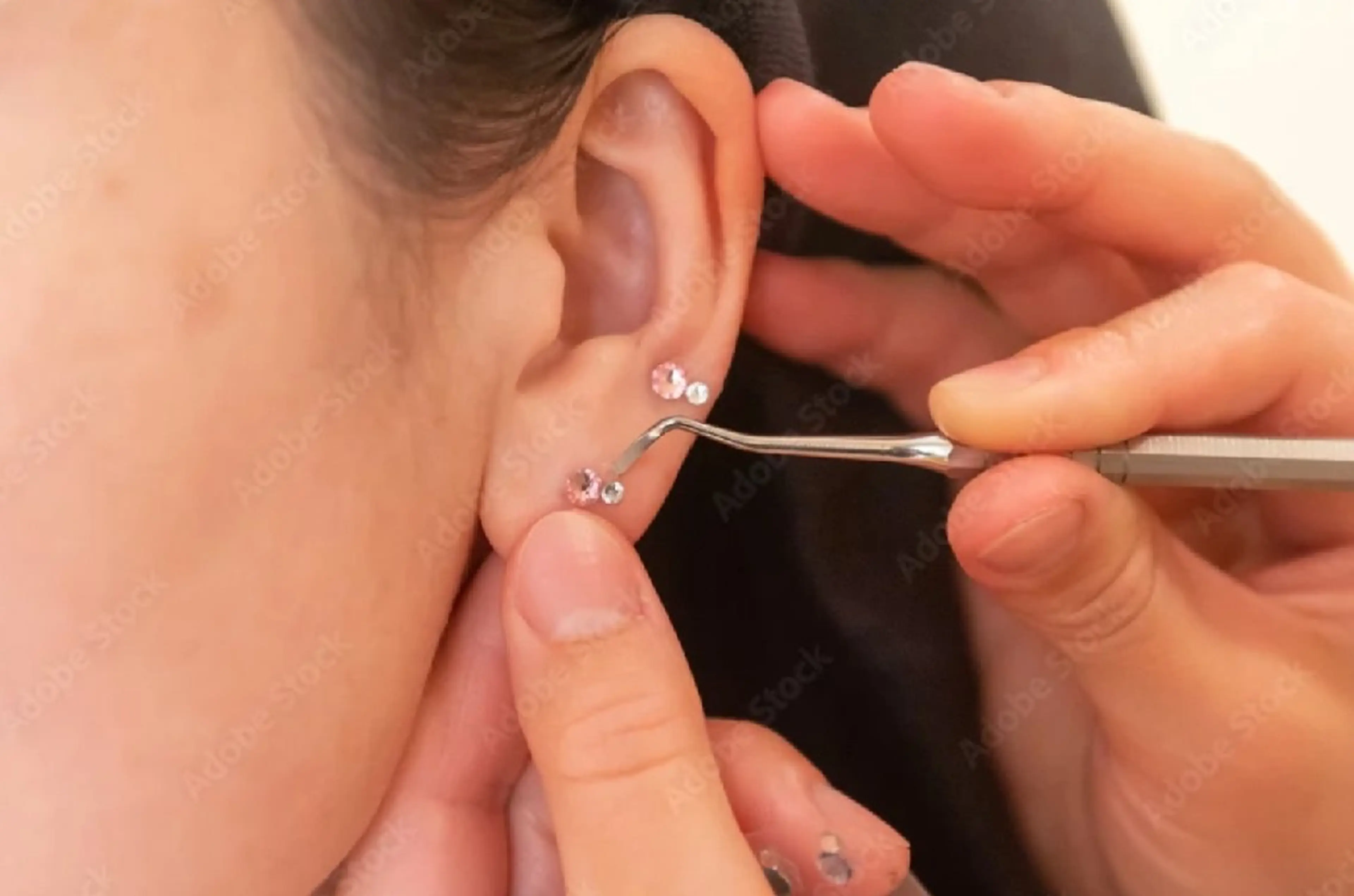 耳つぼジュエリー美容【金粒・銀粒】5粒までの写真