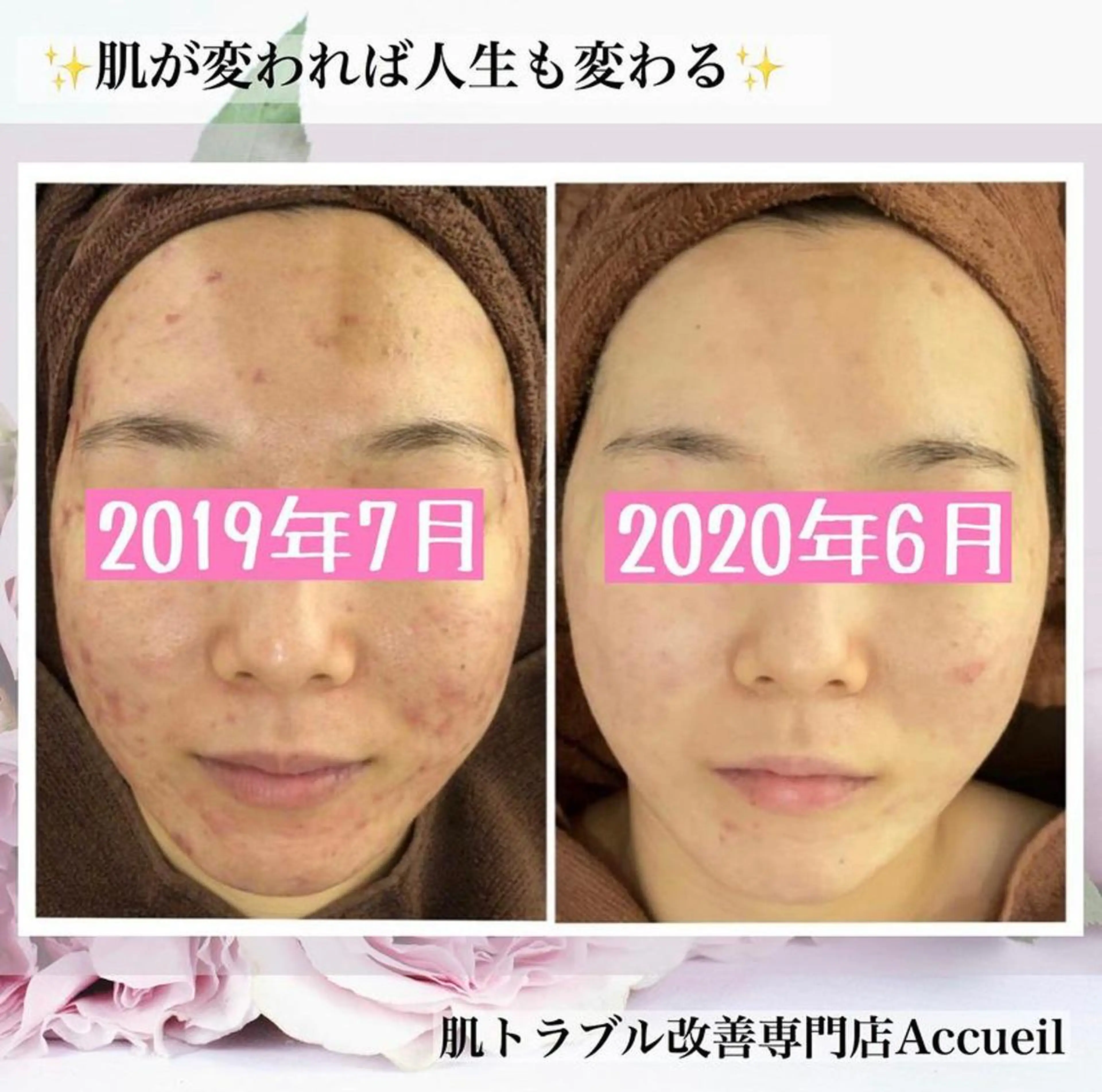 ミディアム カラー パーマ ヘアアレンジ メンズ キッズ ネイル マツエク・マツパ エステ リラク ニキビ・肌質改善専門 ♡人生が変わるサロンのエステ・リラクイメージ