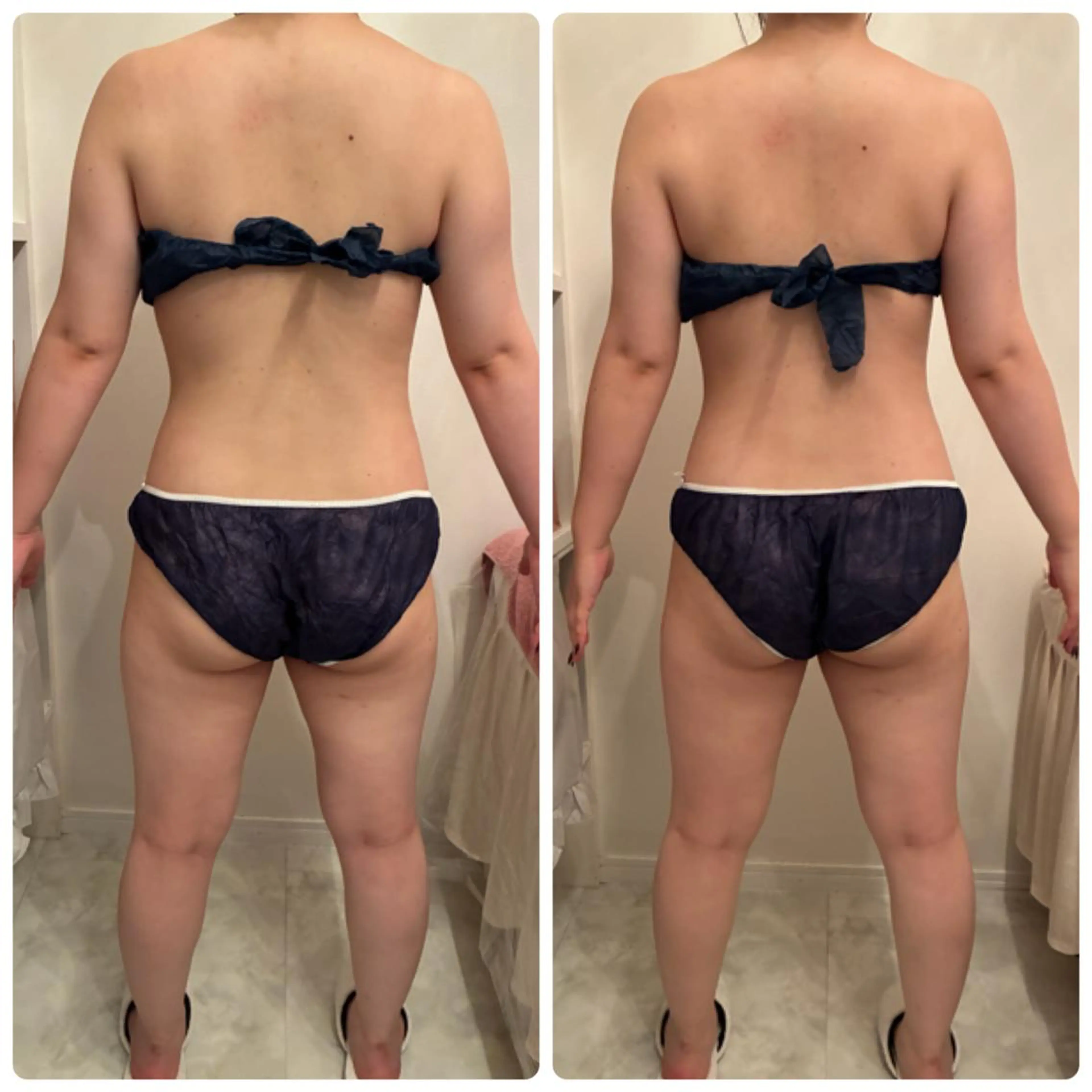 FLEURフェイシャ ル🫧ハーブ🌿小顔のエステ・リラクイメージ