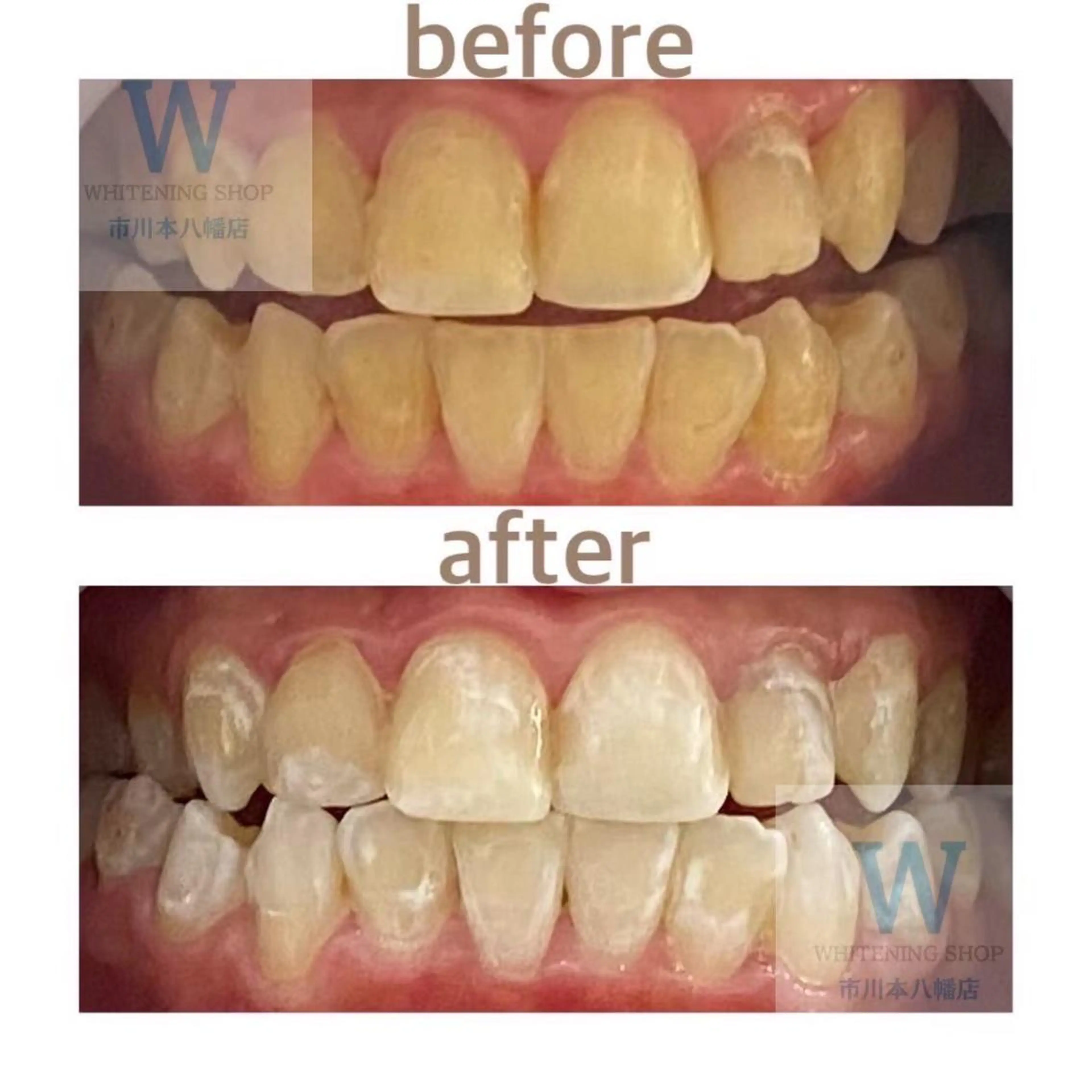 メンズ その他 ホワイトニング ショップ本八幡店のエステ・リラクイメージ