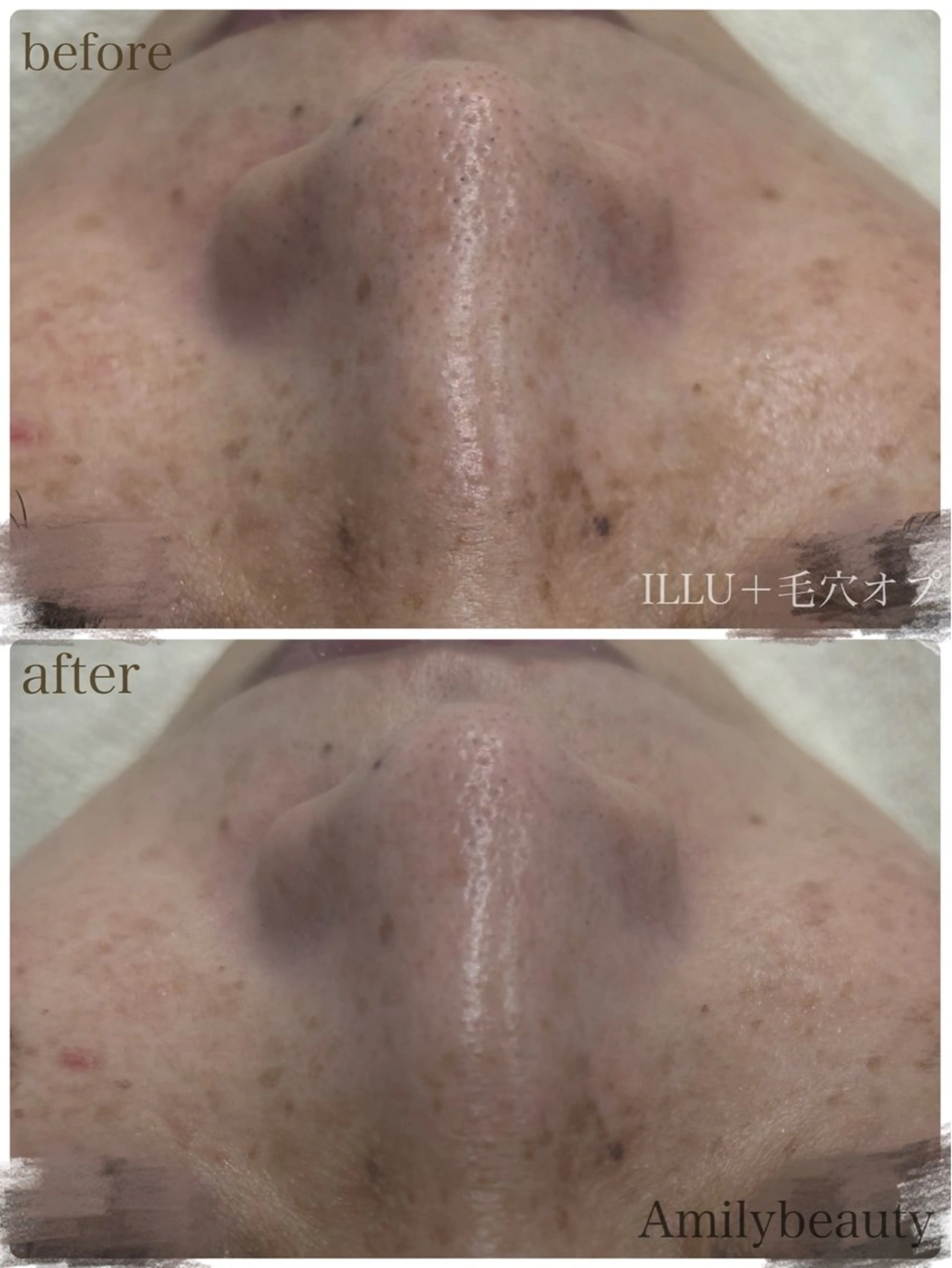 Amilybeauty所属・Amily beauty 毛利のその他イメージ