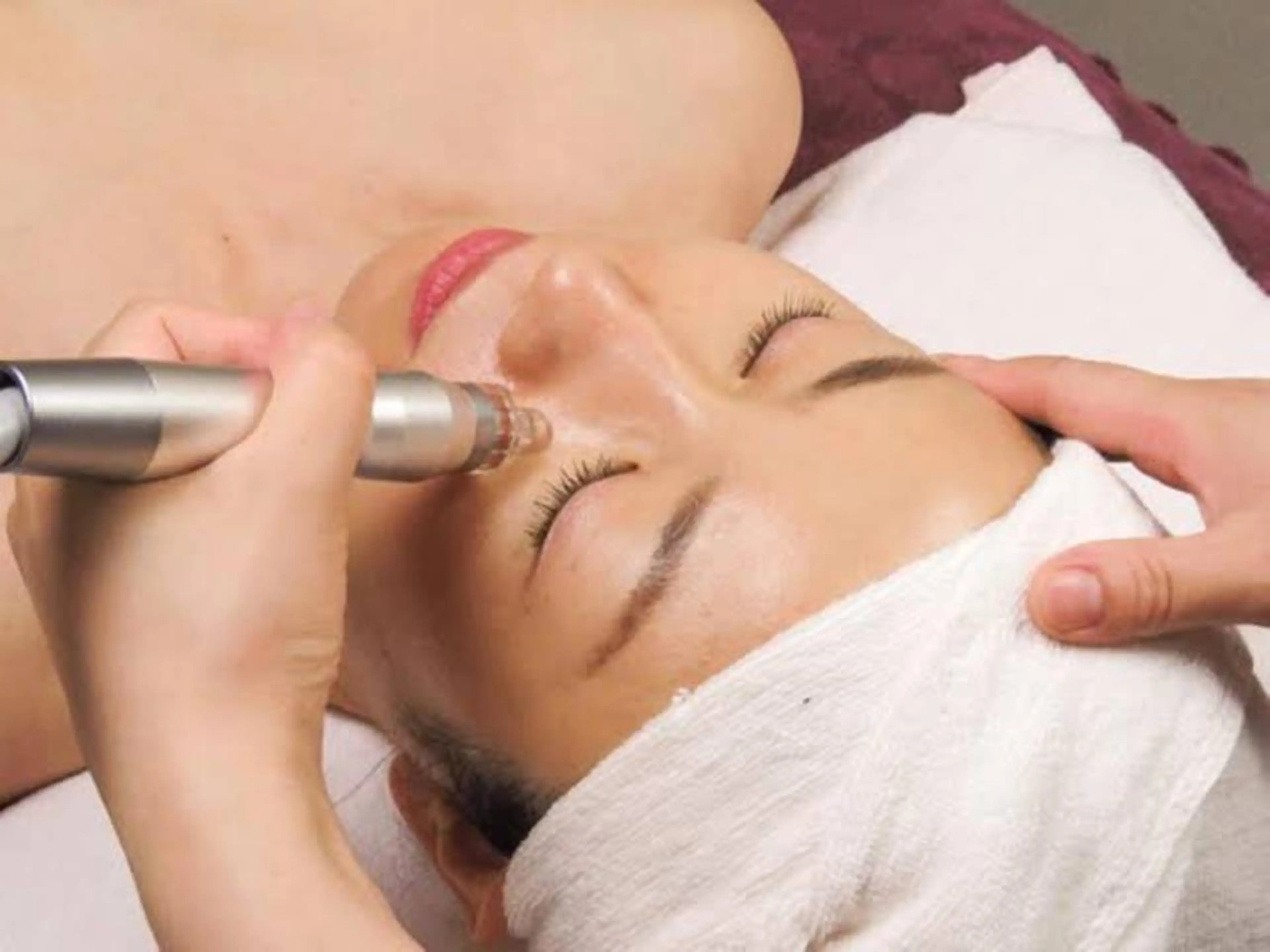 🤍ホワイトニングエステ🤍くすみ改善＆美白！カウンセリング無料！施術の場合￥3900の写真