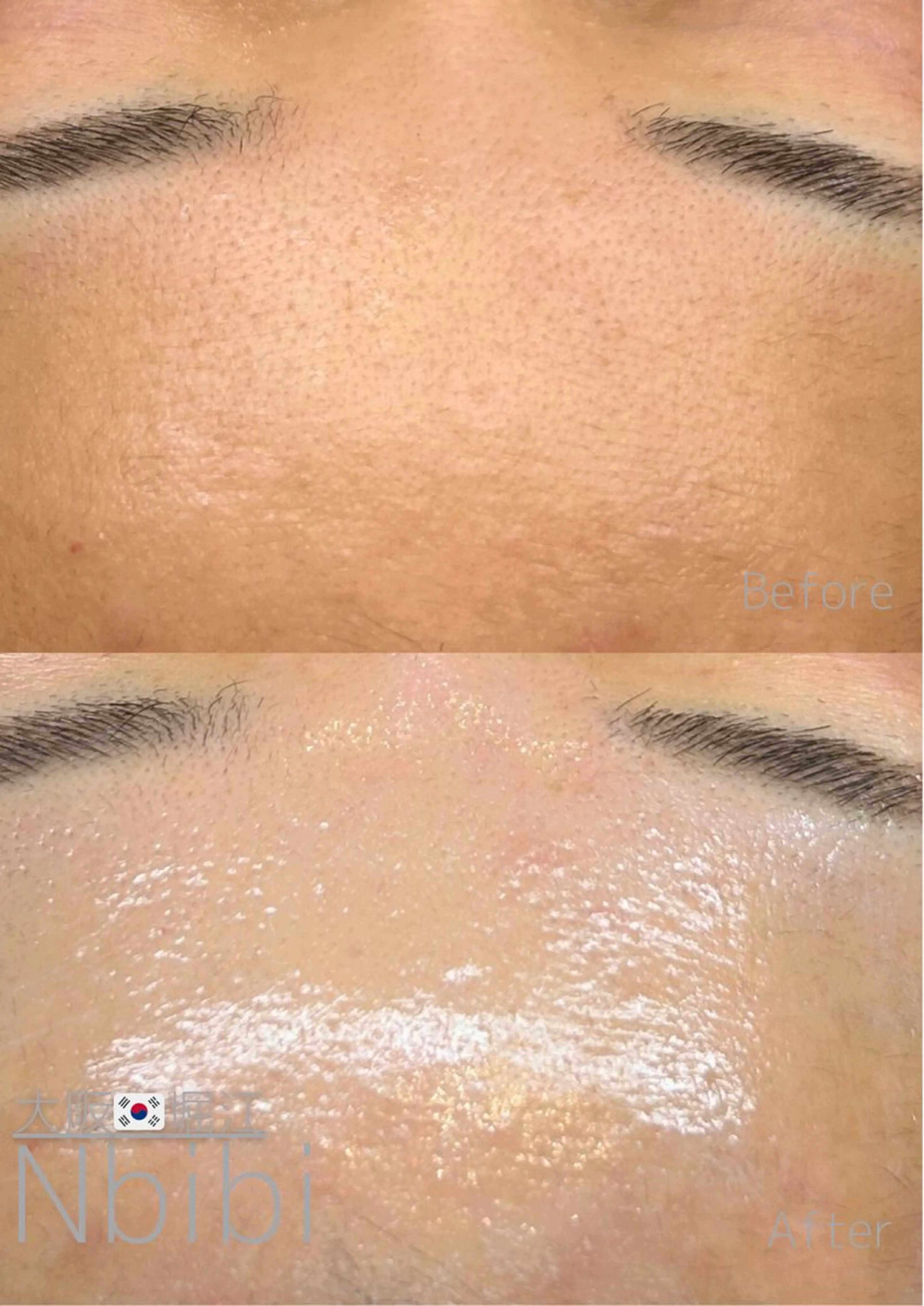 エステ 韓国🇰🇷価格 サロン_Nbibiのエステ・リラクイメージ