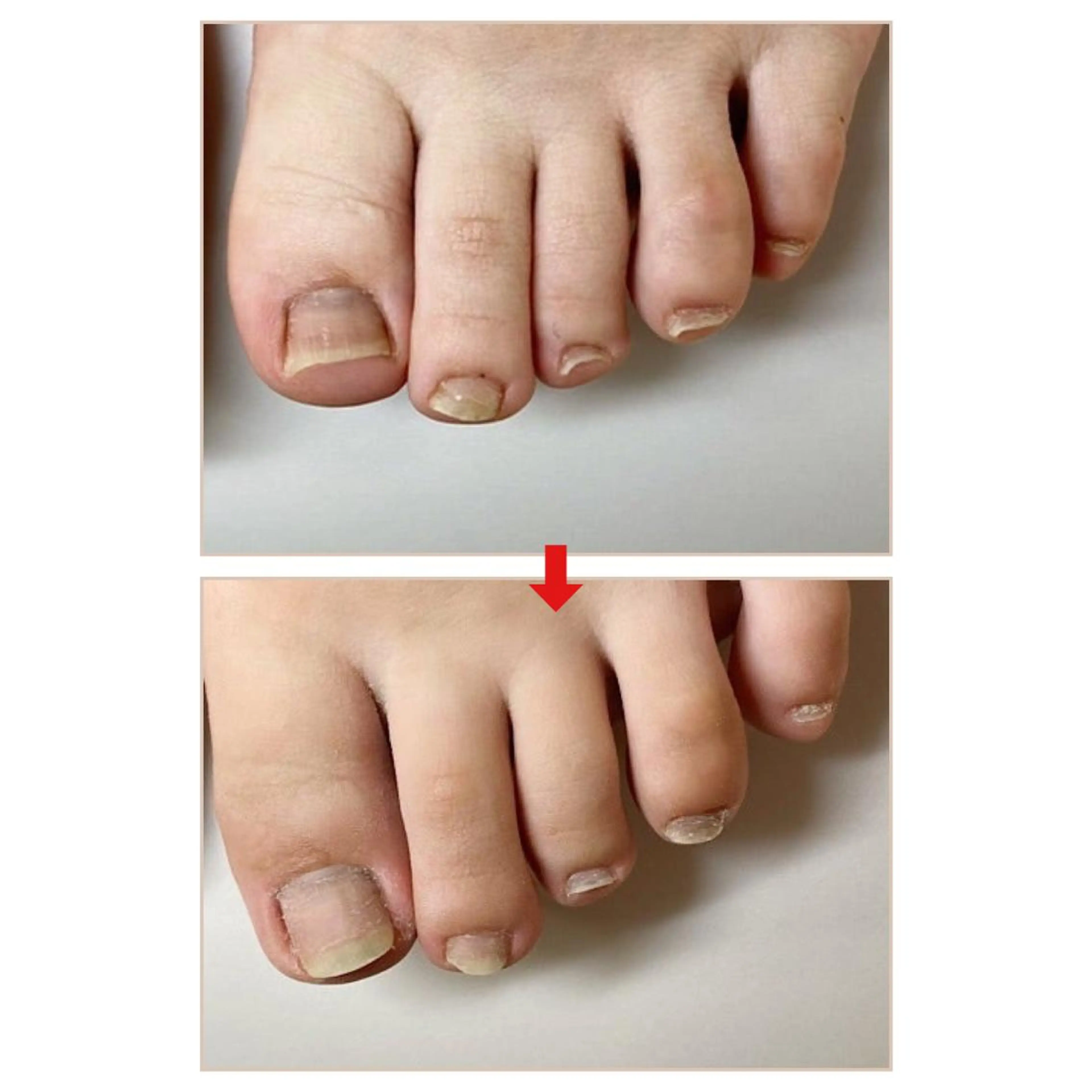 ネイル ネイルサロンアリューム所属・ネイルサロン アリュームのネイルデザイン