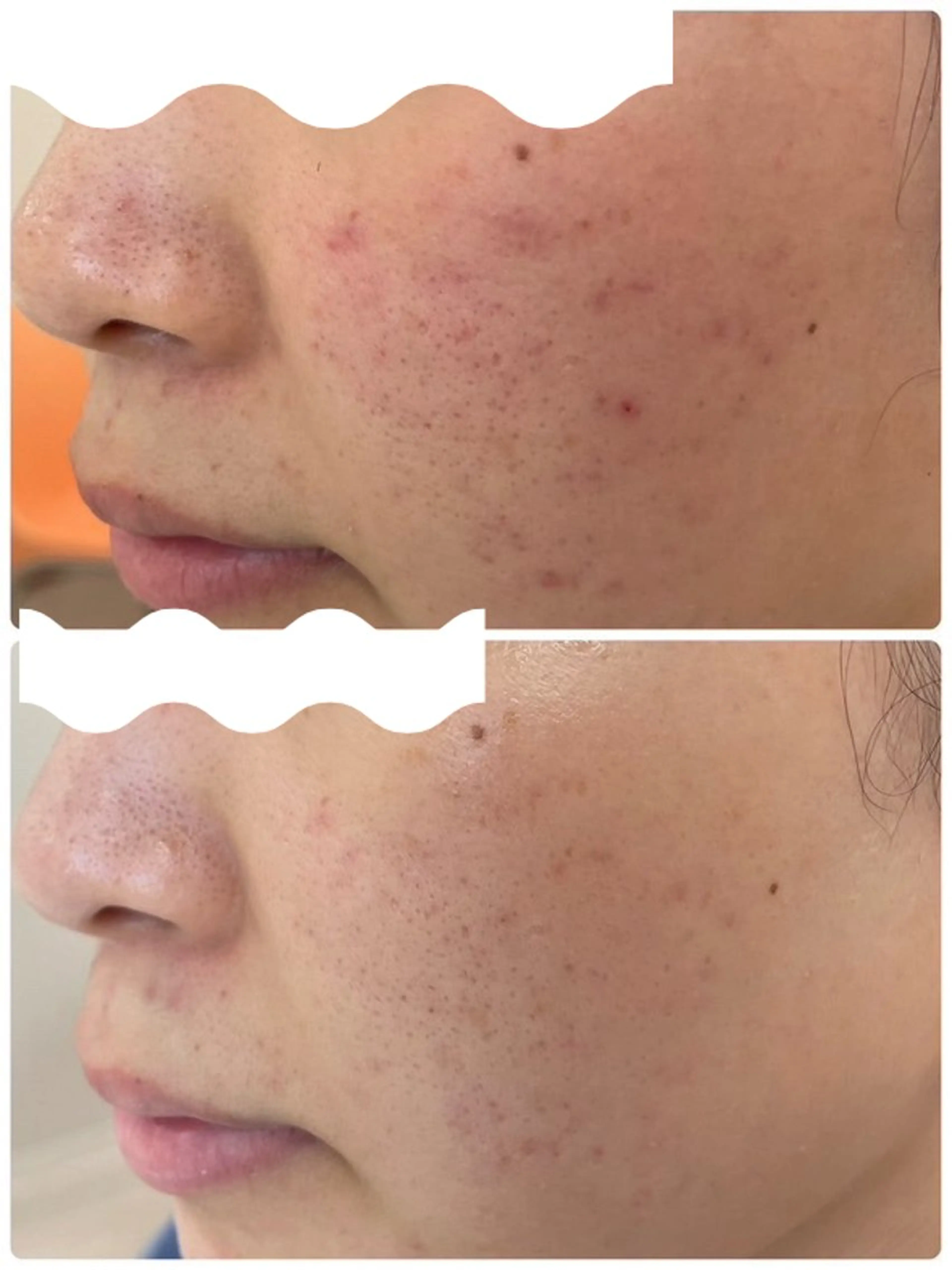 ありな/巡りを整える肌質改善サロン所属・ありな 肌質改善サロンのエステ・リラクイメージ