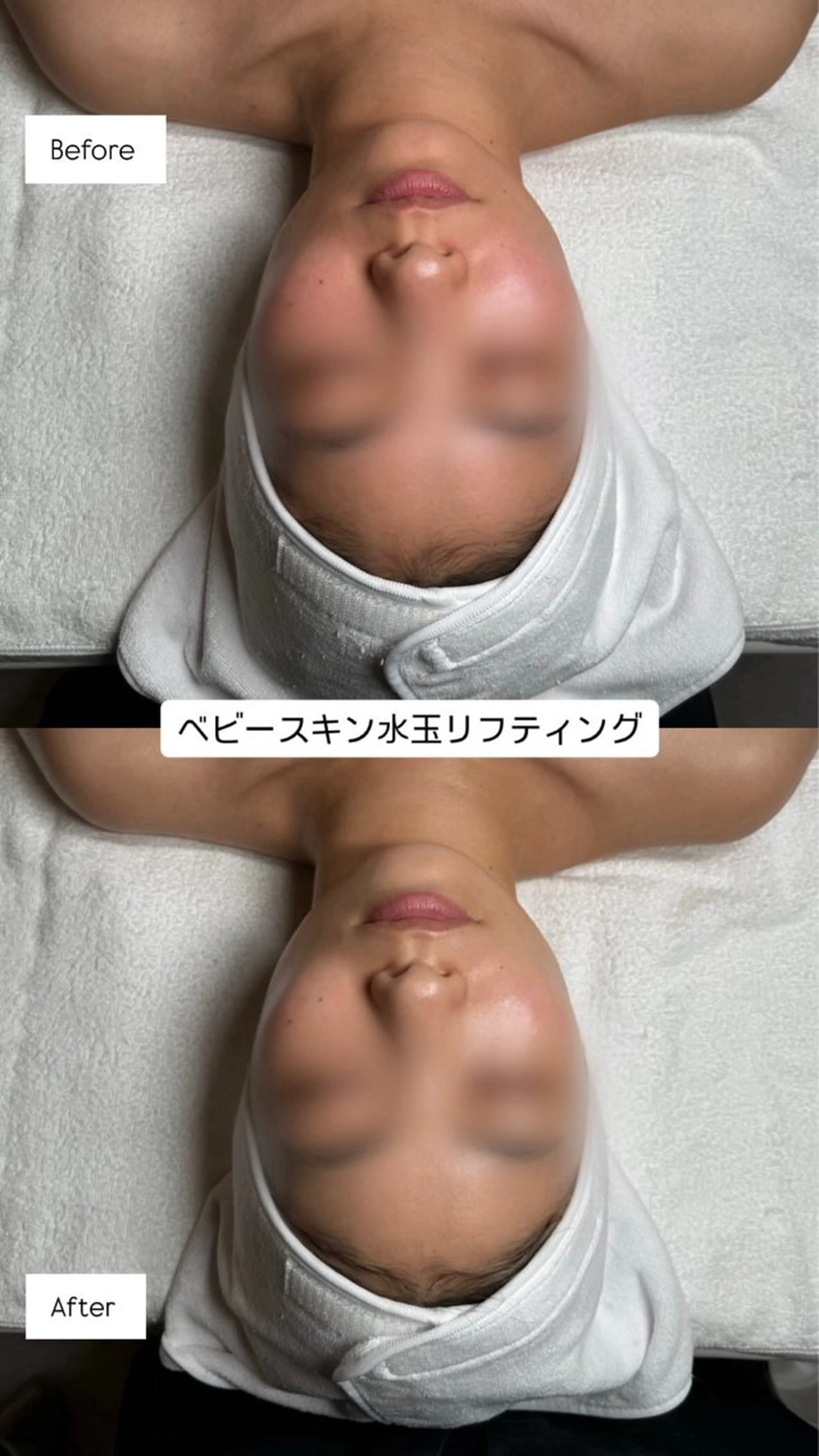 韓国肌管理🫧LDM 🫧Junnaのエステ・リラクイメージ