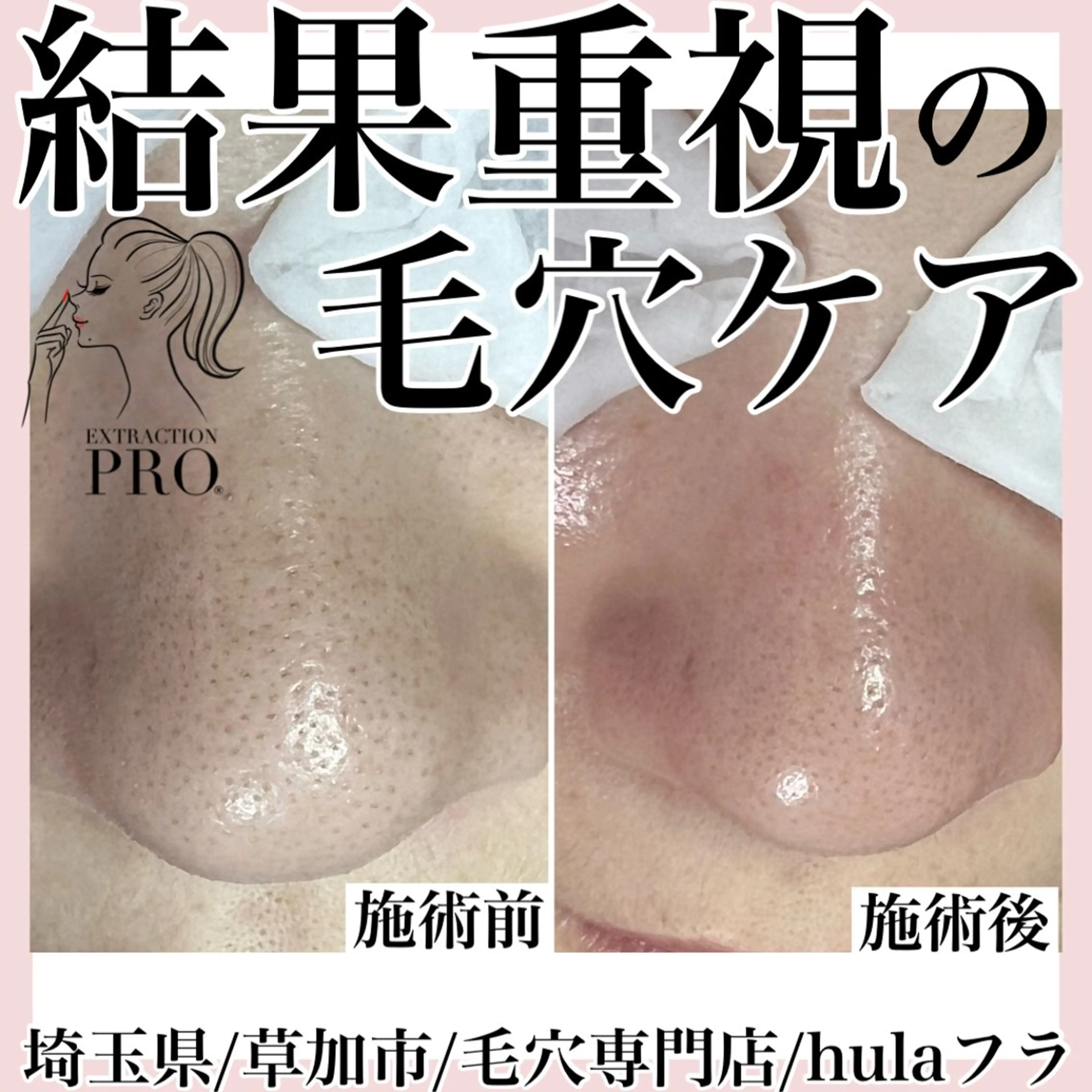 エステ 毛穴専門店hula 杉山智美のエステ・リラクイメージ