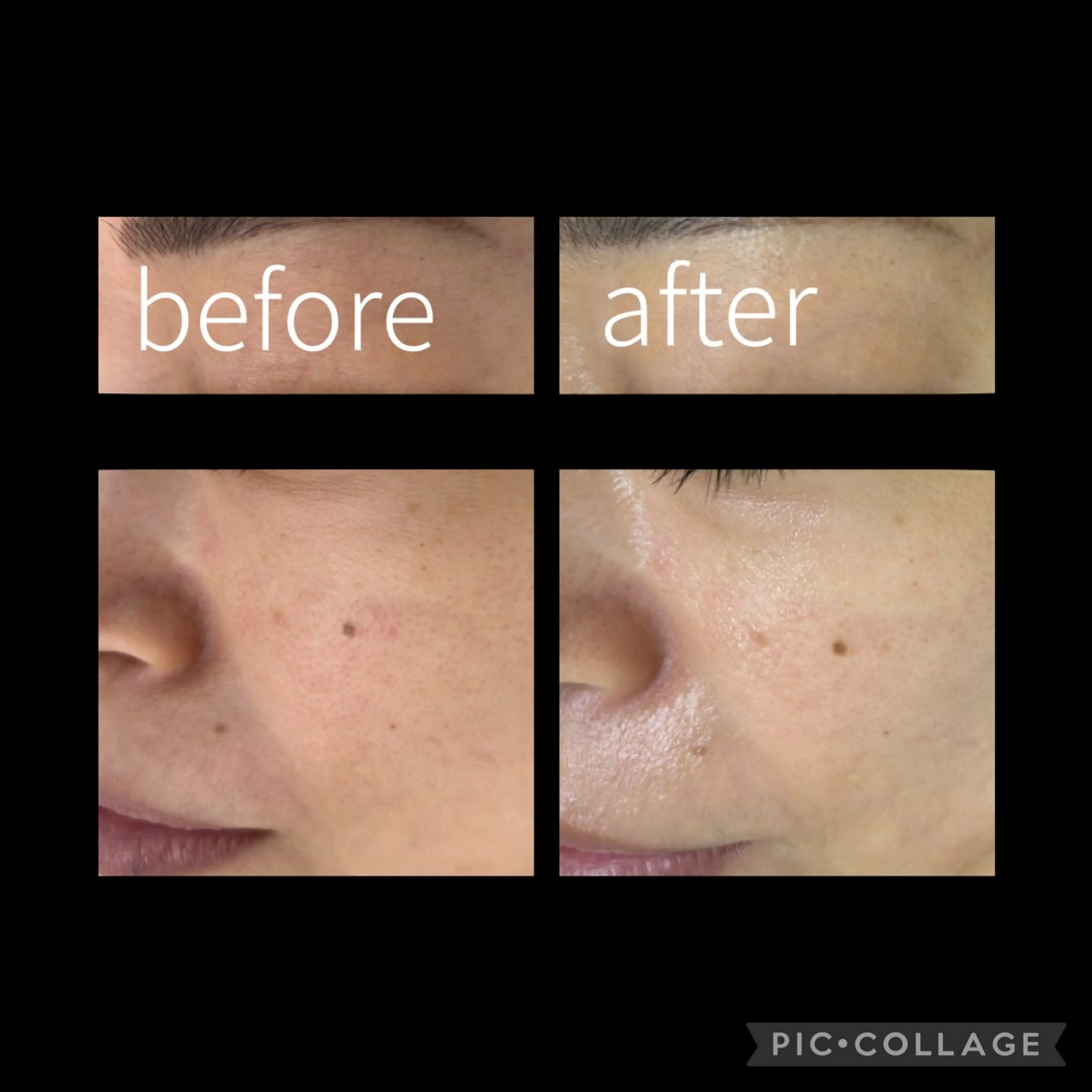 DeI'm柴田所属・【肌質改善サロン】 Harunaのネイルデザイン