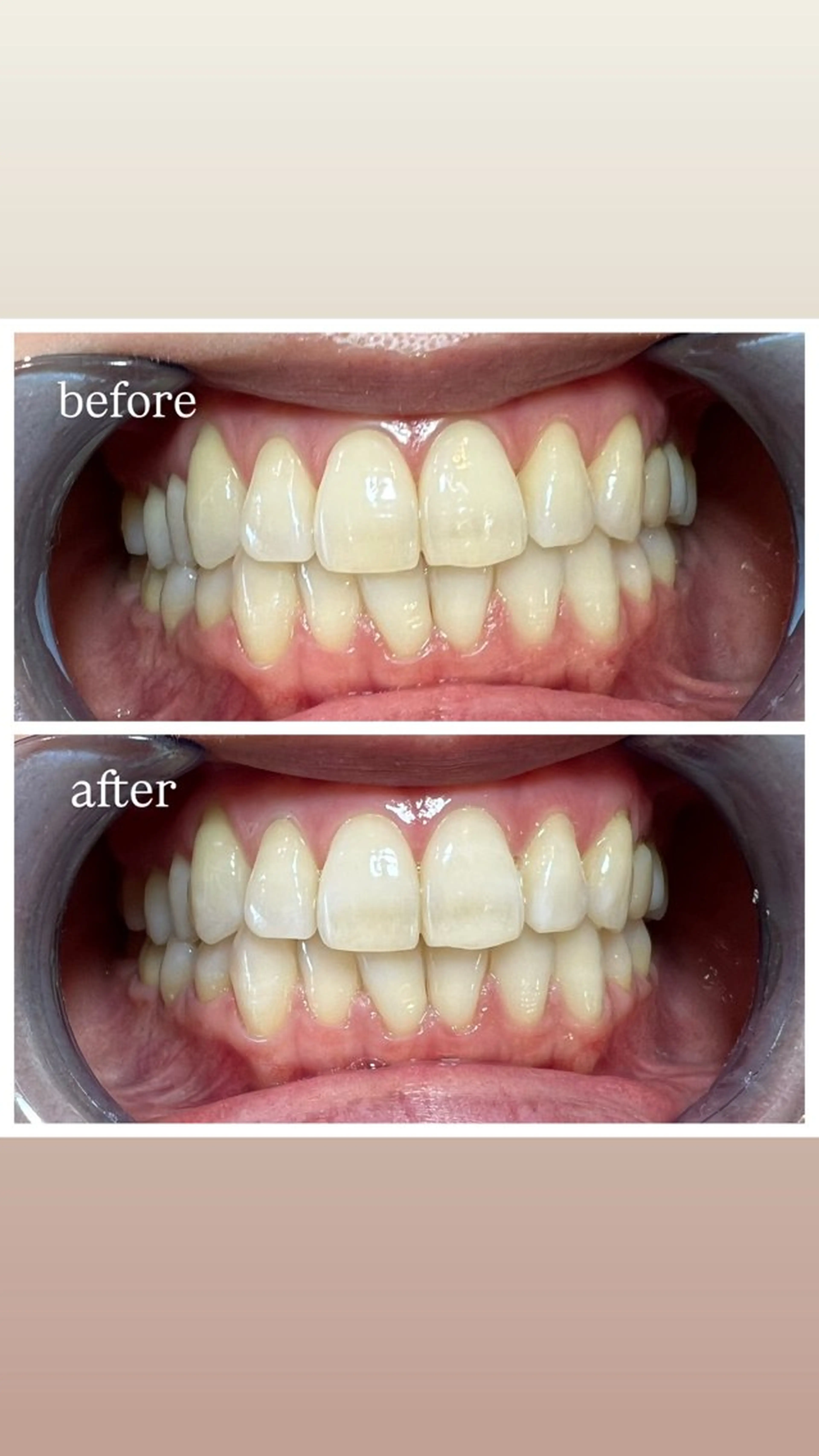 セルフホワイトニング Shineeのエステ・リラクイメージ