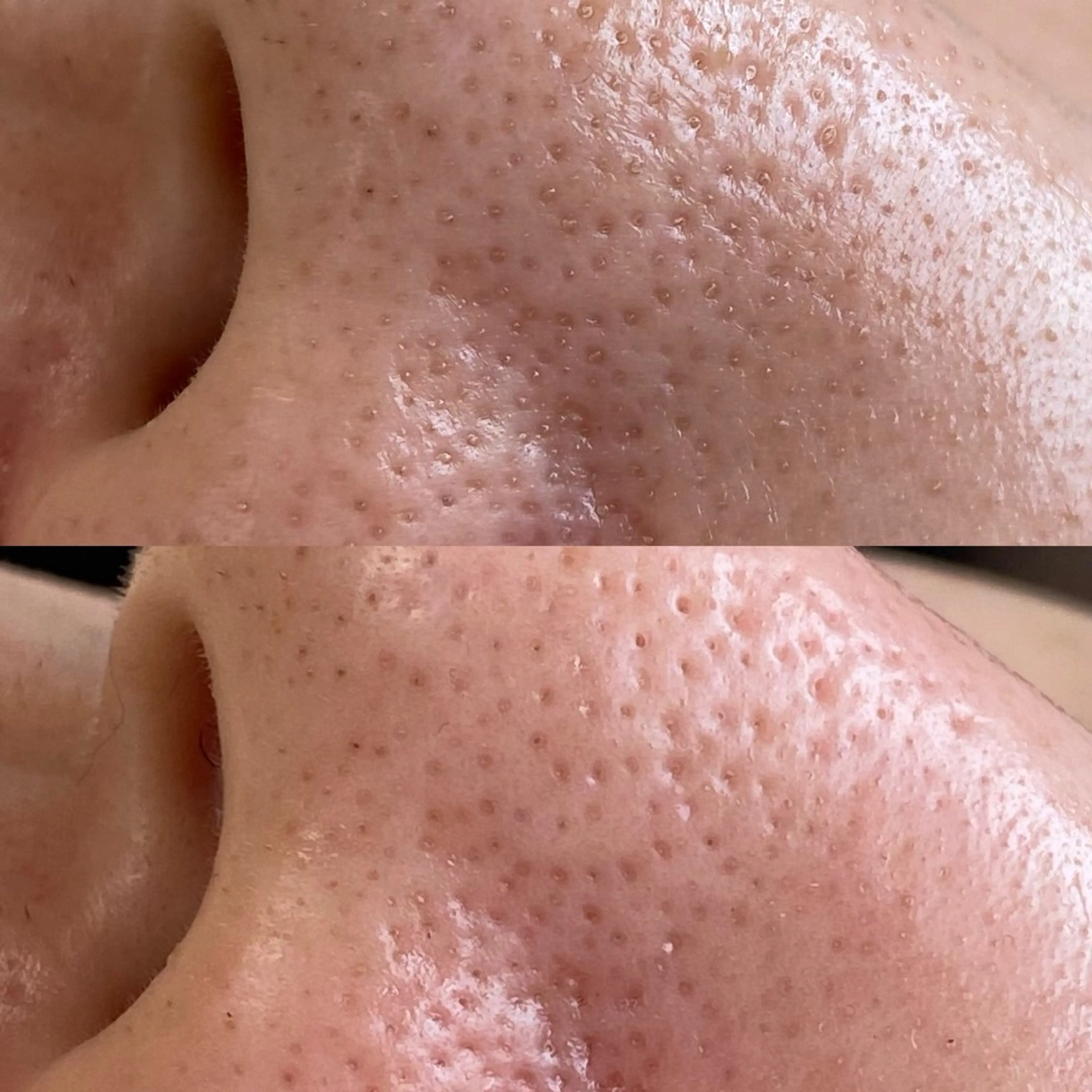 はり灸サロン　totonoi所属・印象の良くなる 美容鍼のエステ・リラクイメージ