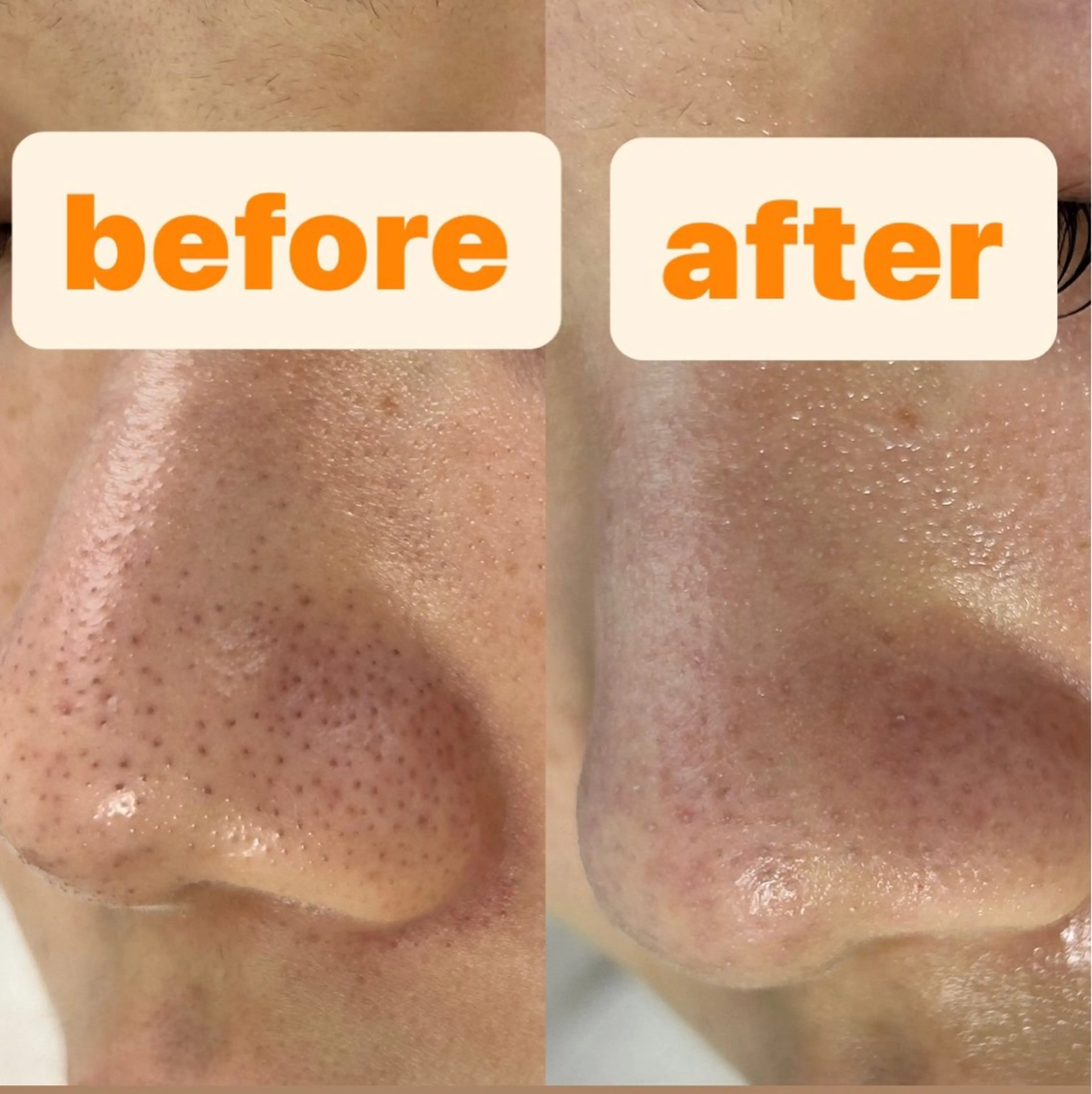 都度払い肌改善専門店 店長二上文香のエステ・リラクイメージ