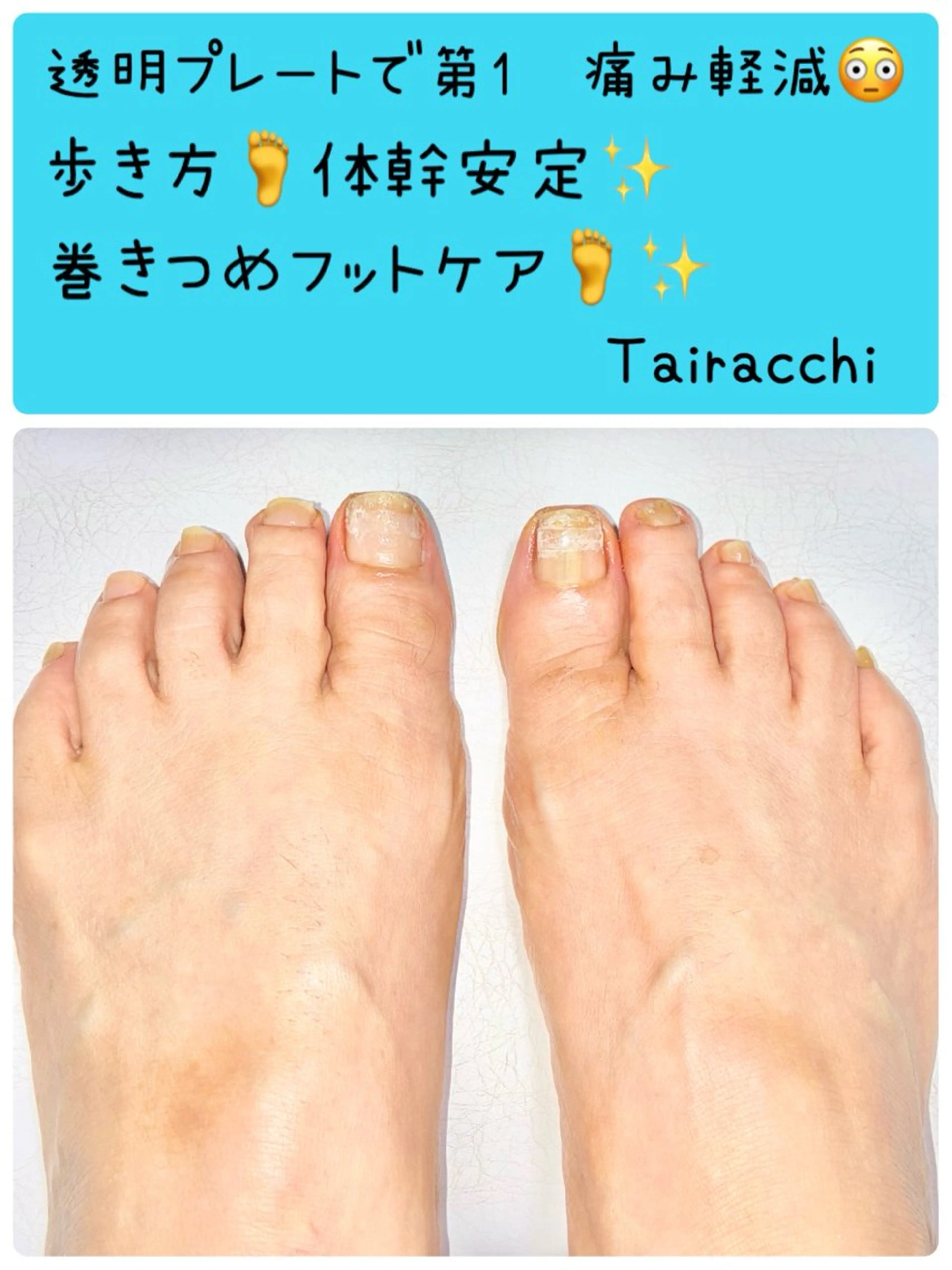 ネイル フットネイル Tairacchi ﾀｲﾗｯﾁのエステ・リラクイメージ