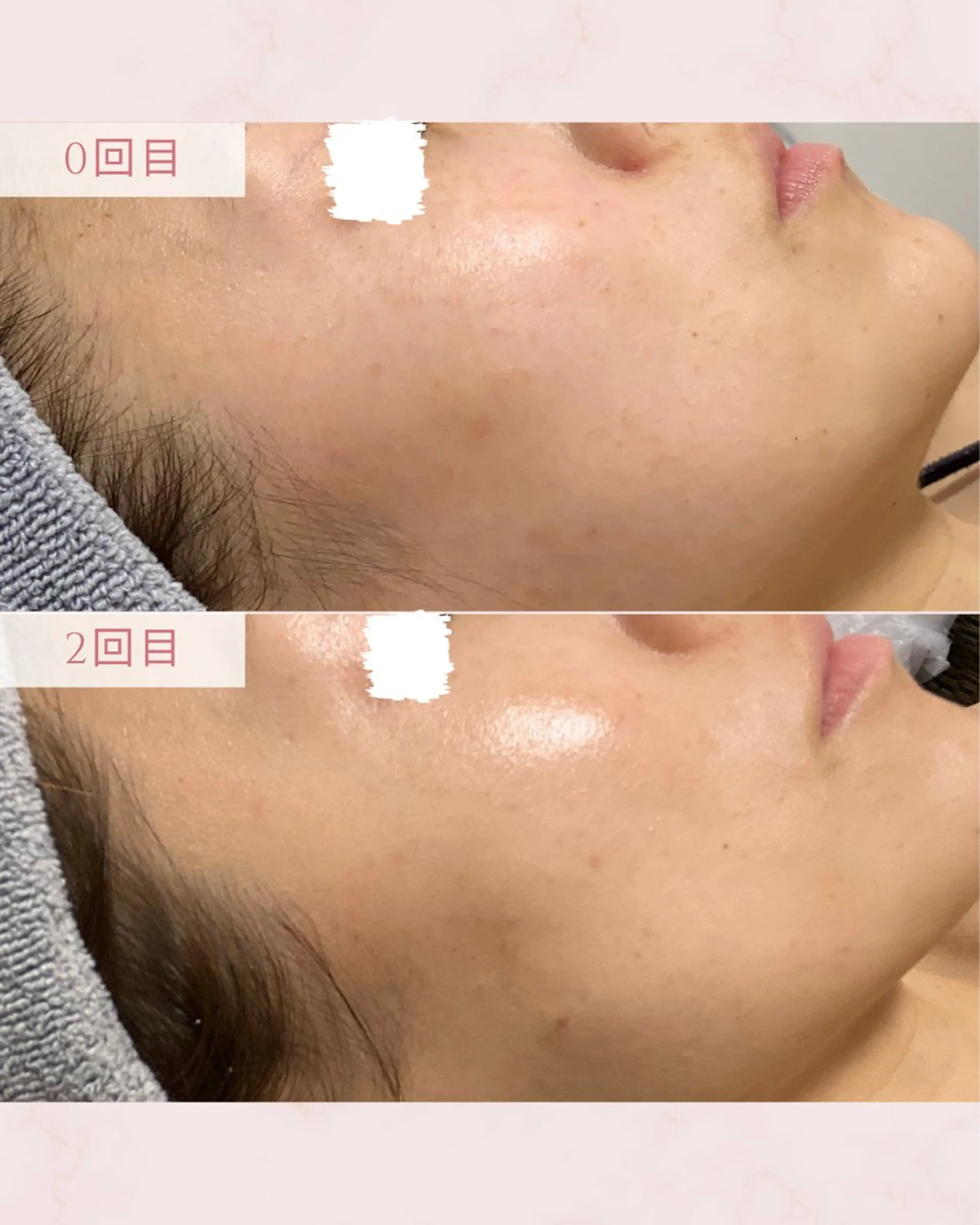 エステ MAUM-美 caresalon-のエステ・リラクイメージ