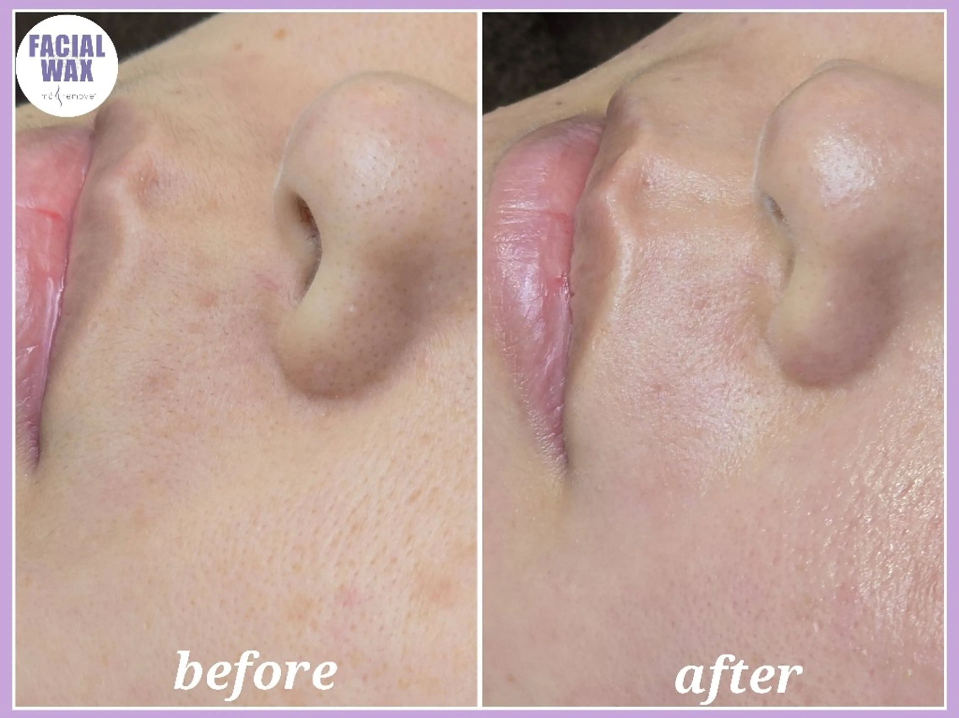 エステ facial salon Lily所属・salon Lilyのエステ・リラクイメージ