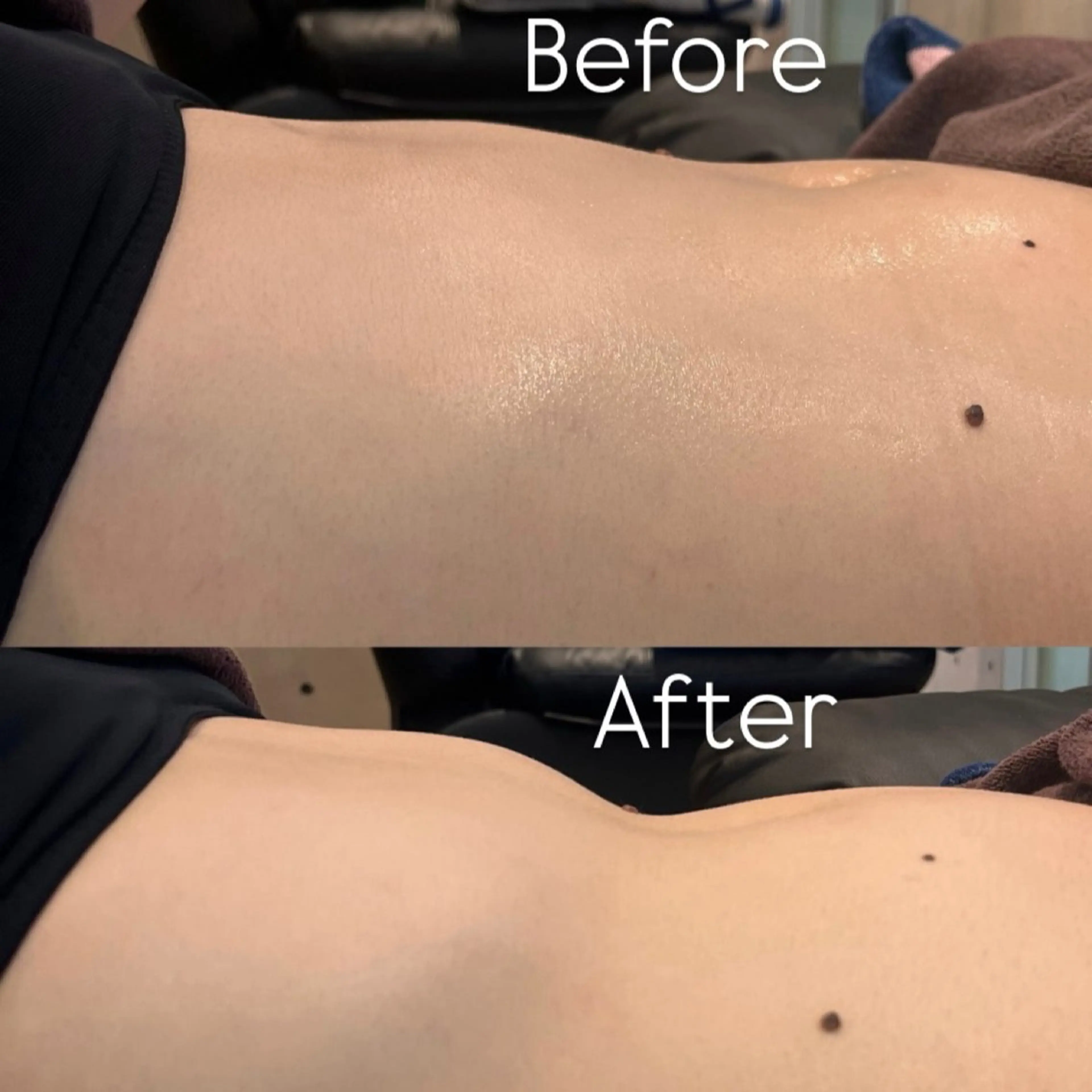 Joo🌿肌育/高岳 アトピー/肌質改善のエステ・リラクイメージ