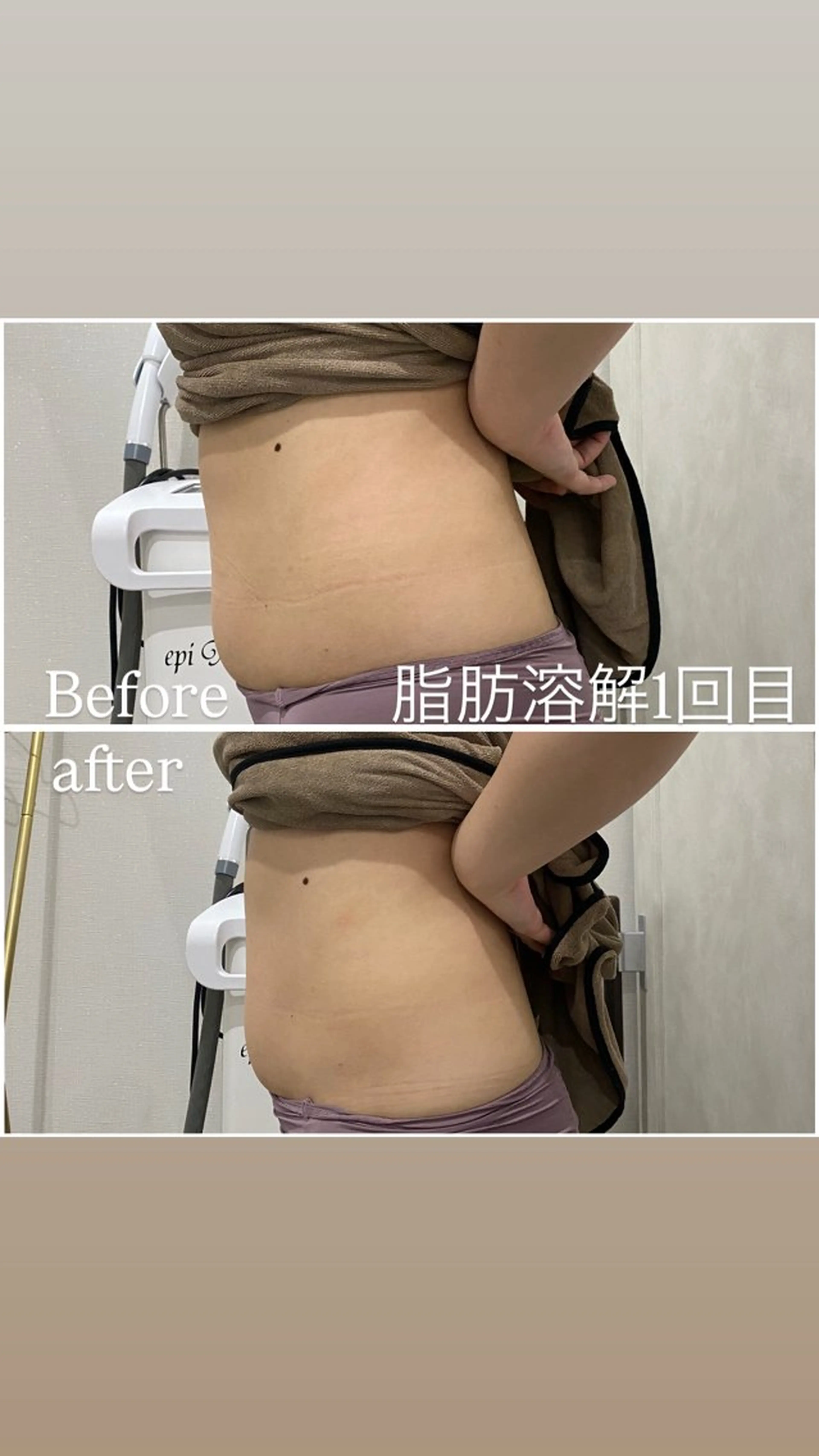 エステ 毛穴洗浄・痩身・脱毛 /アルカンジュのエステ・リラクイメージ