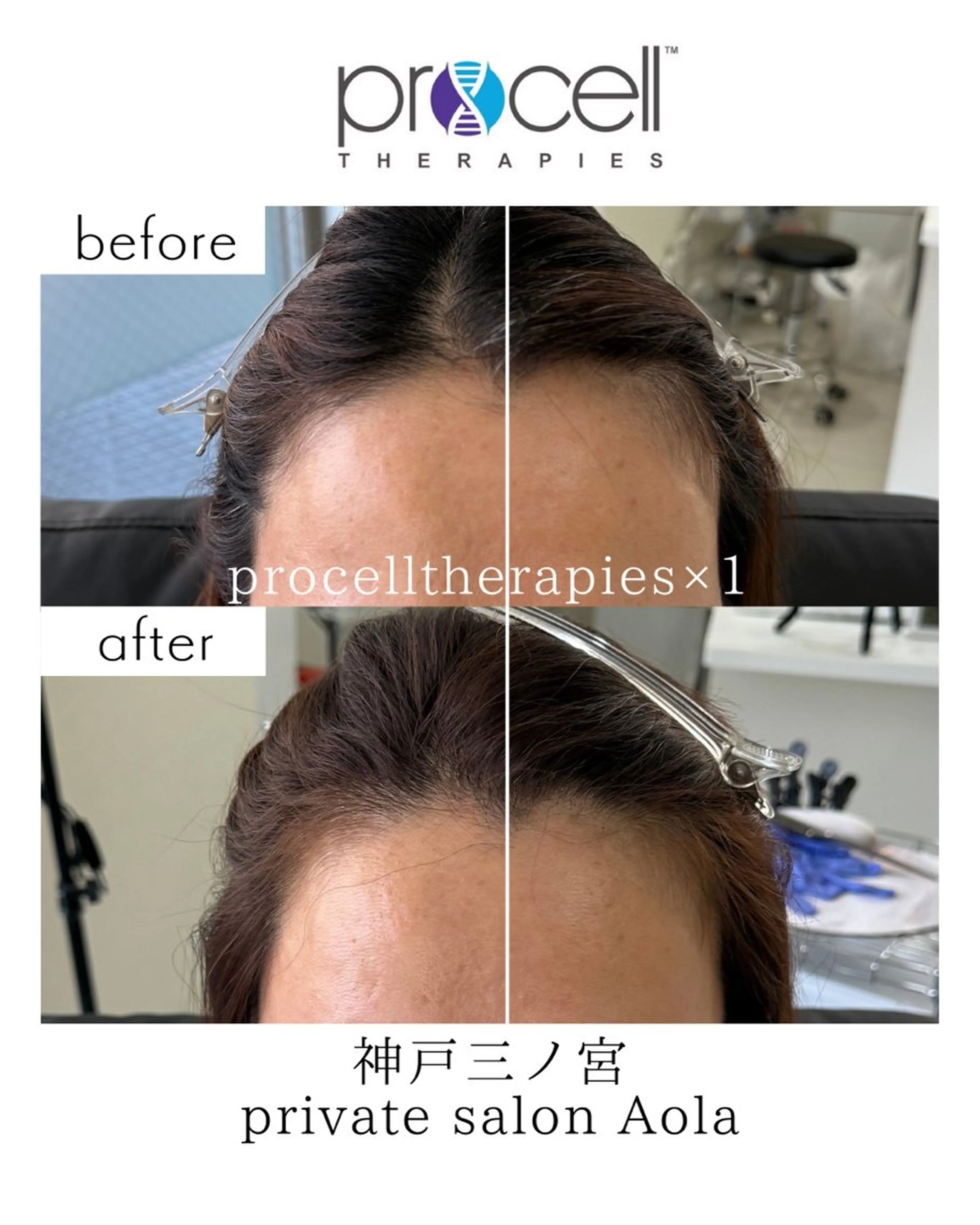 private salon Aola所属・プライベートサロン アオラのネイルデザイン