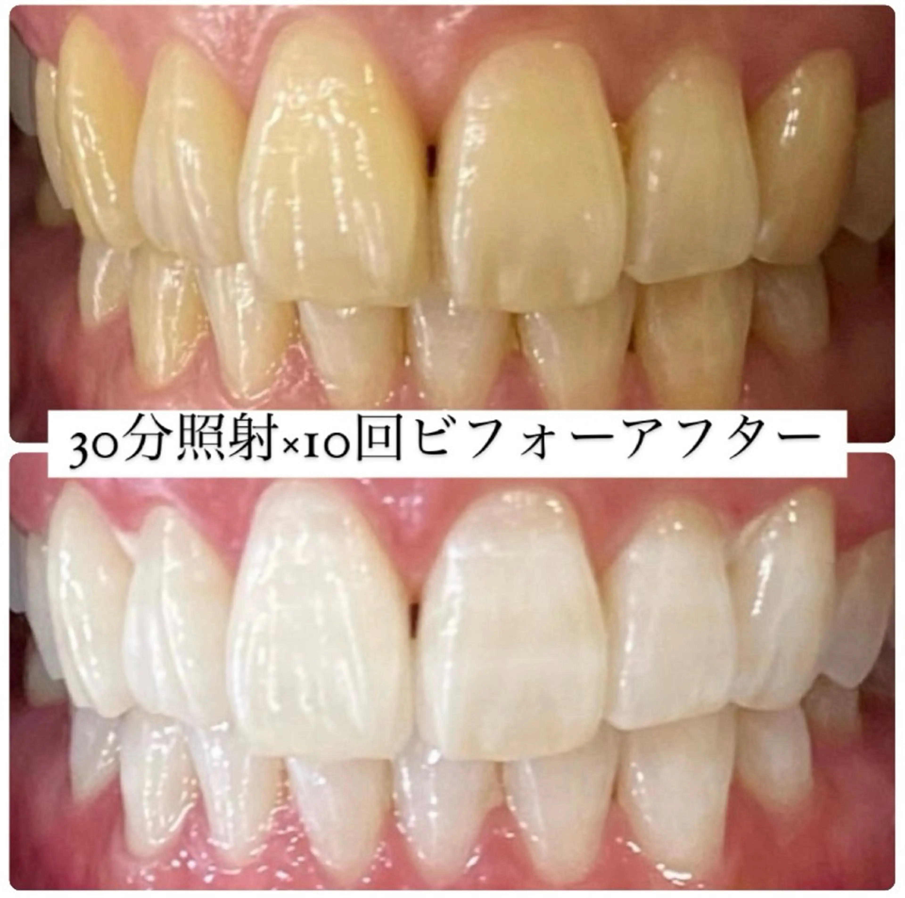 PLATINUM Beauty 横浜店所属・ホワイトニングルーム 横浜店のその他イメージ