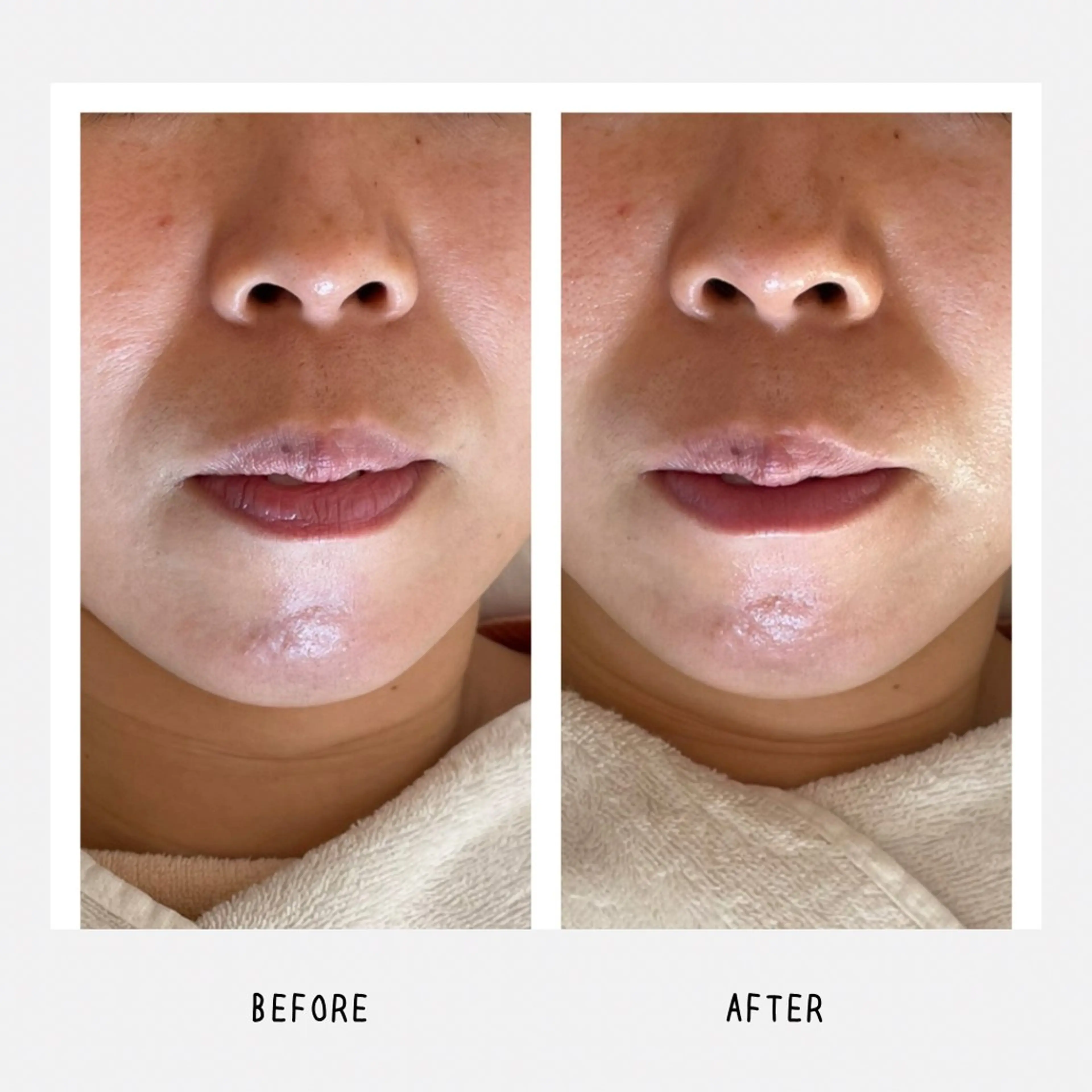 grow所属・Yoshino Erinaのエステ・リラクイメージ