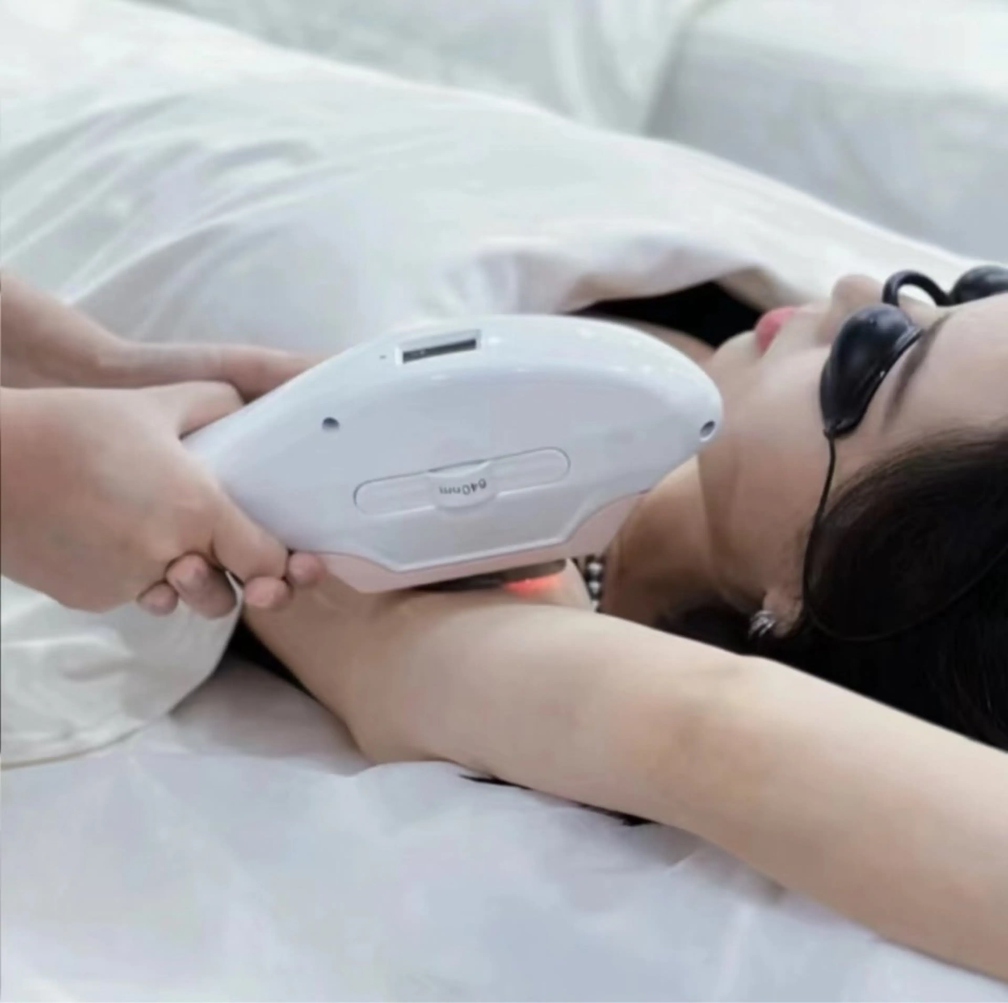 【3ヶ所◆パーツ脱毛】お好きな部位が選べる!肌に優しいピンポイント脱毛♪の写真