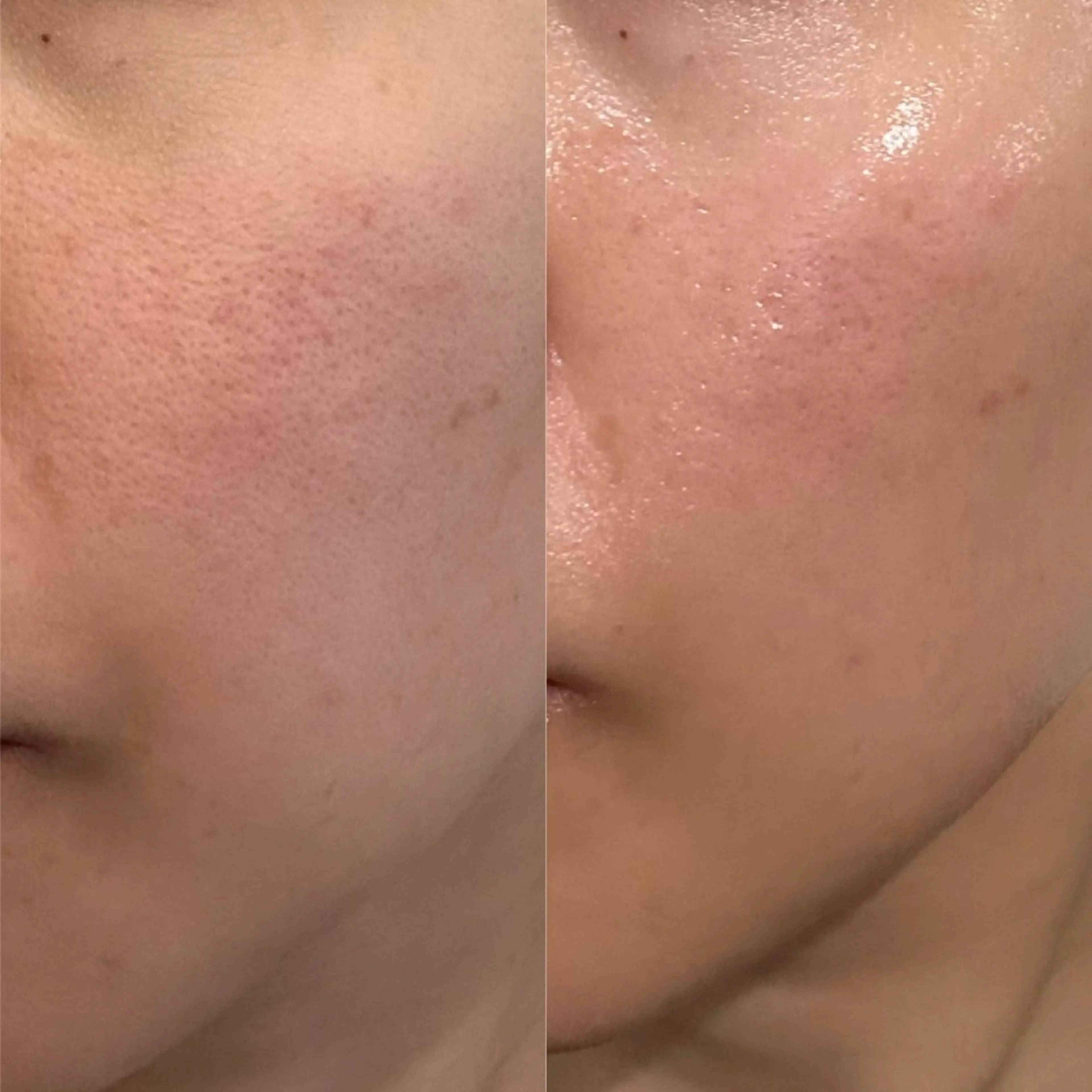 エステ インディバサロン　ソレイユ所属・indiba soleilのエステ・リラクイメージ