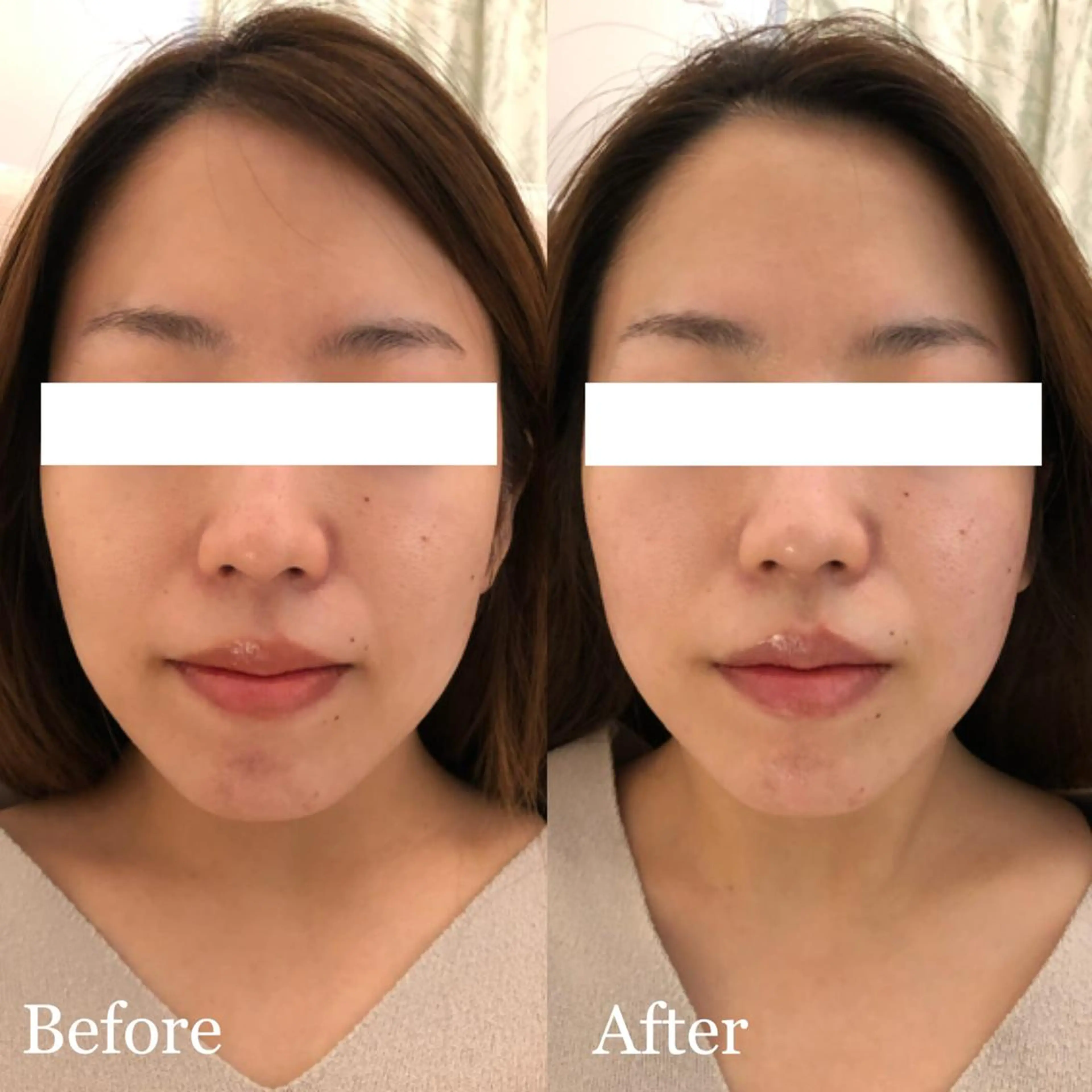 ✨美肌水光✨ アトリエリュバンのエステ・リラクイメージ