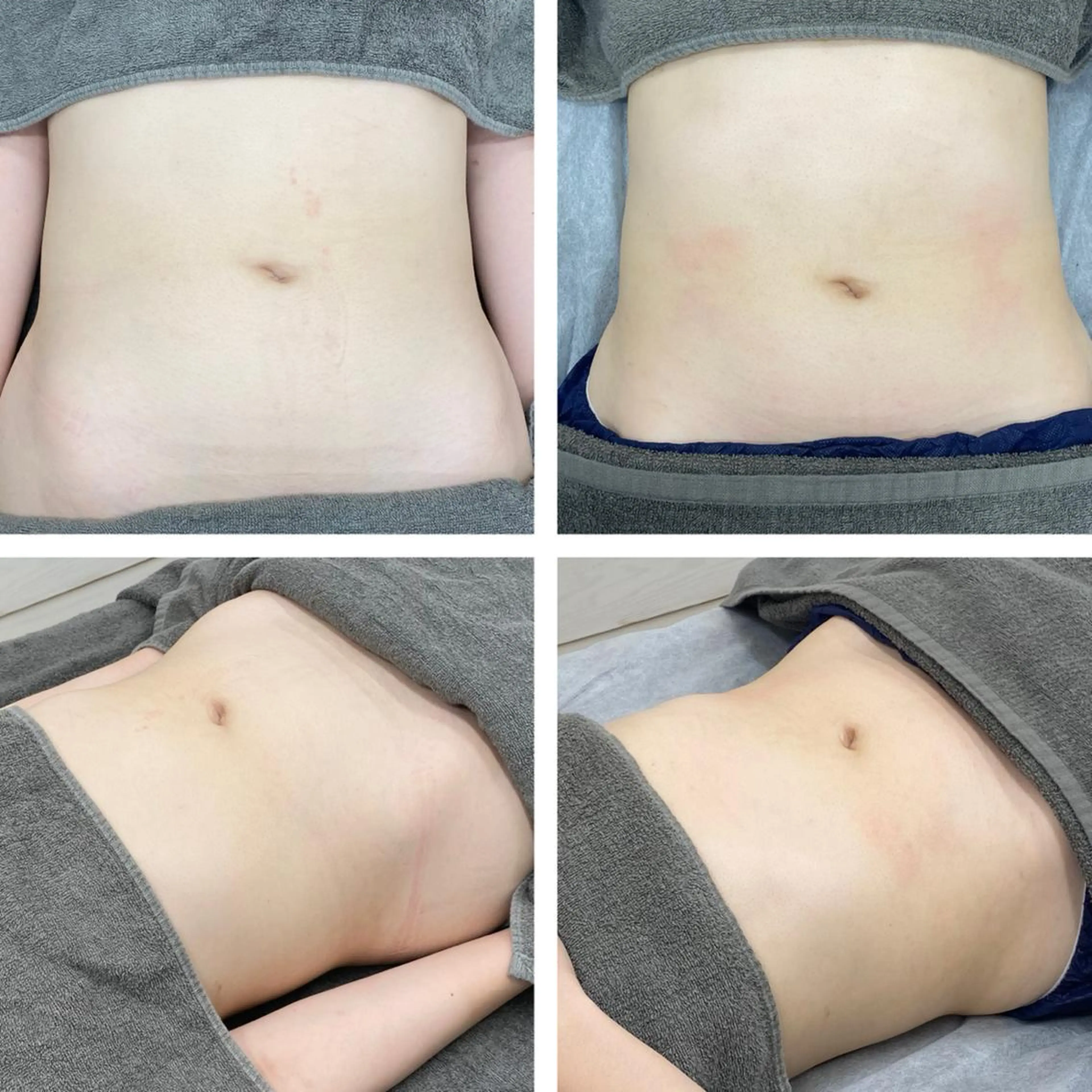 温活未病ケアサロン CoQのエステ・リラクイメージ