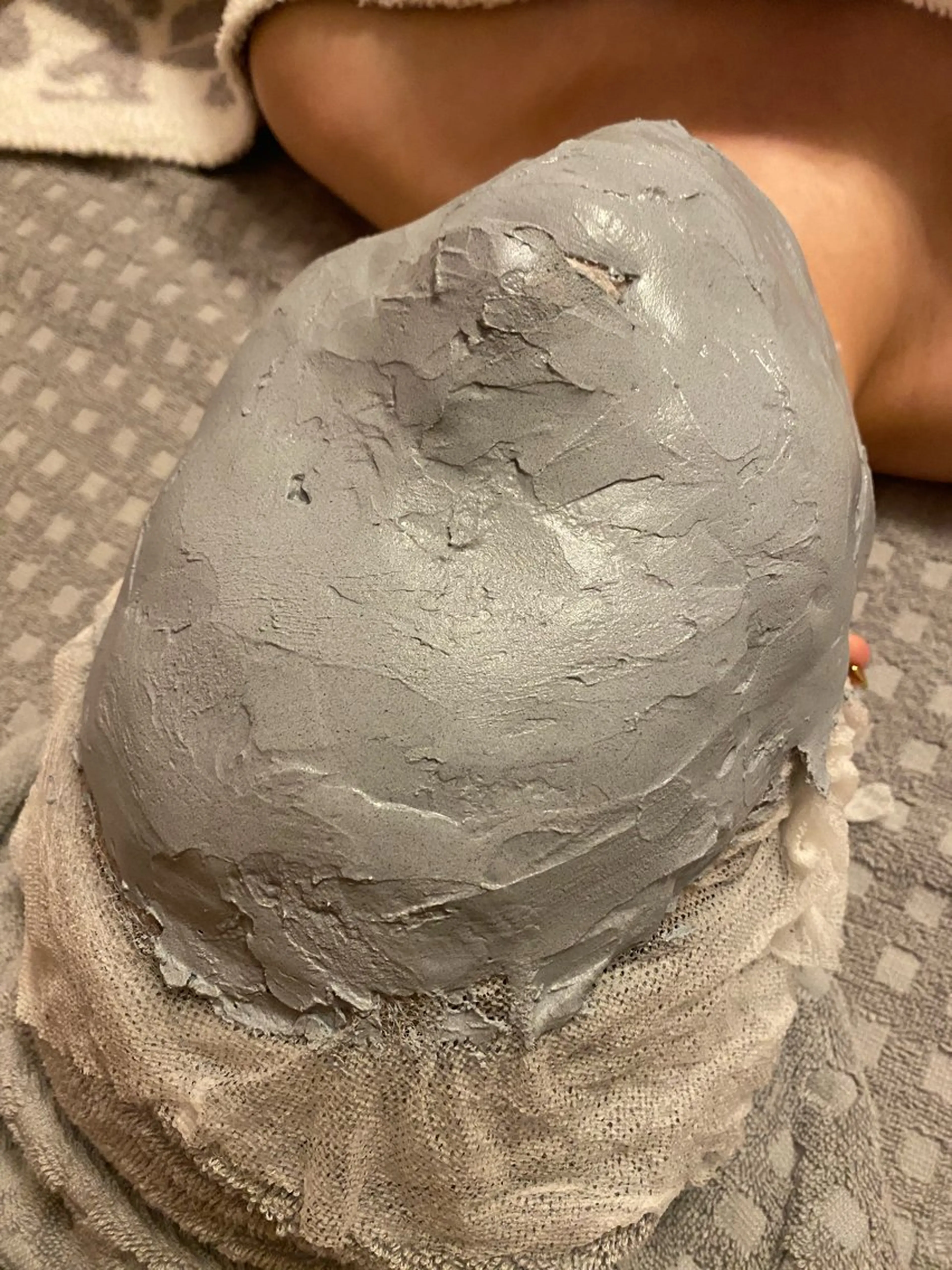 【モニター】小顔・美白コース(石膏パック)💎の写真