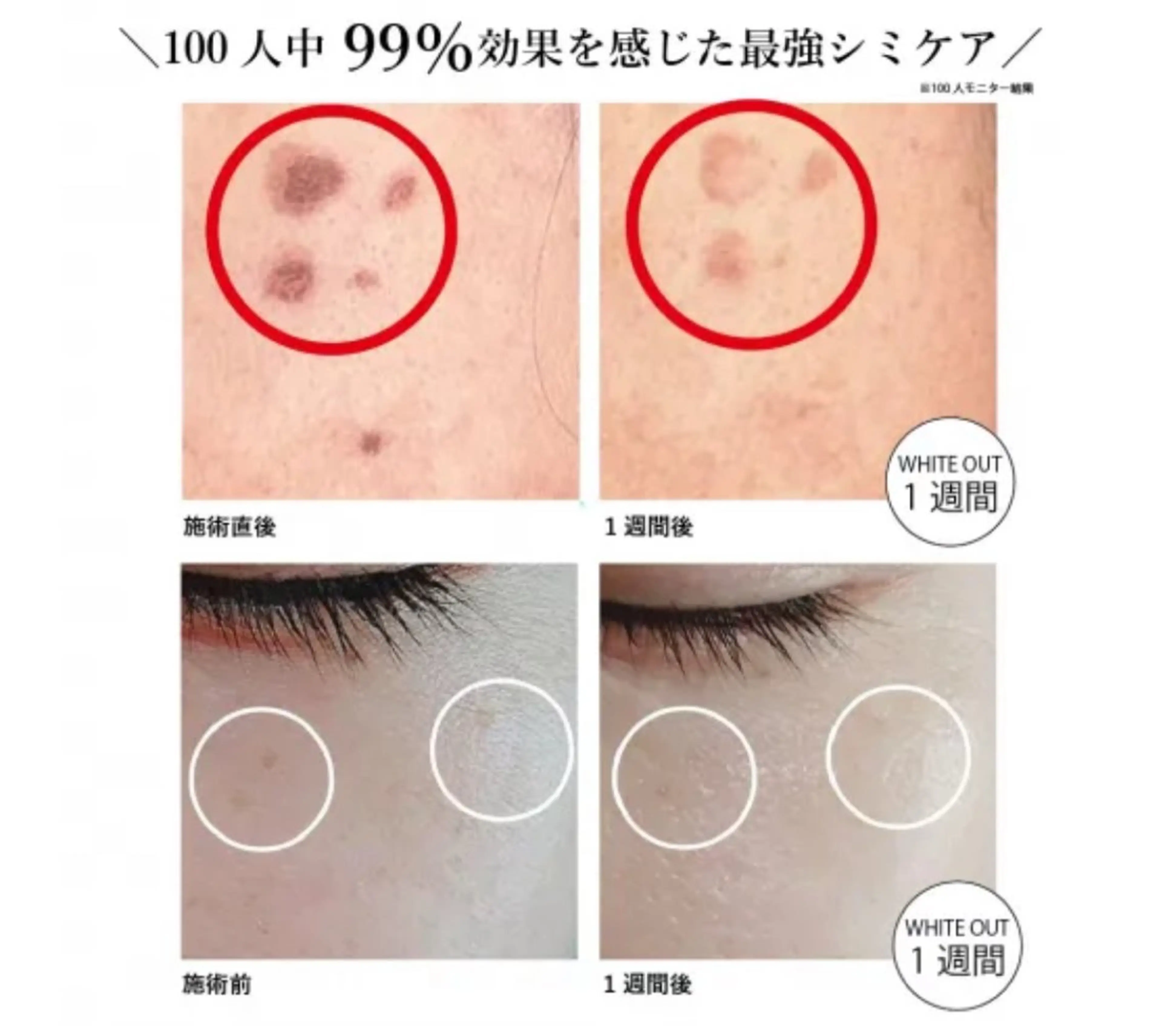 📍【相談無料／施術は¥5000​〜​】シミのお悩み相談はこちらからの写真