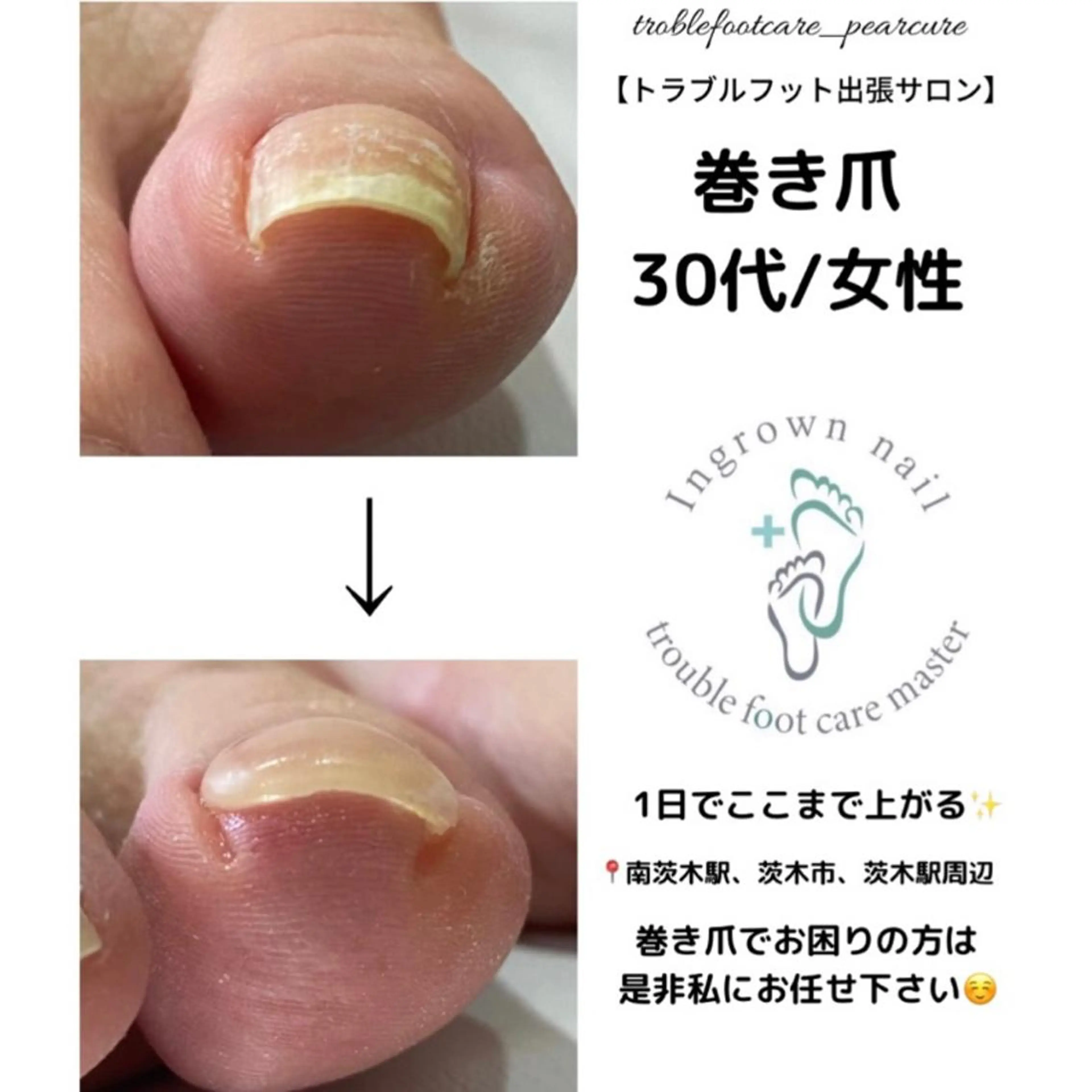 ネイル フットネイル 梨ネイルとJR茨木所属・井上 愛梨のネイルデザイン