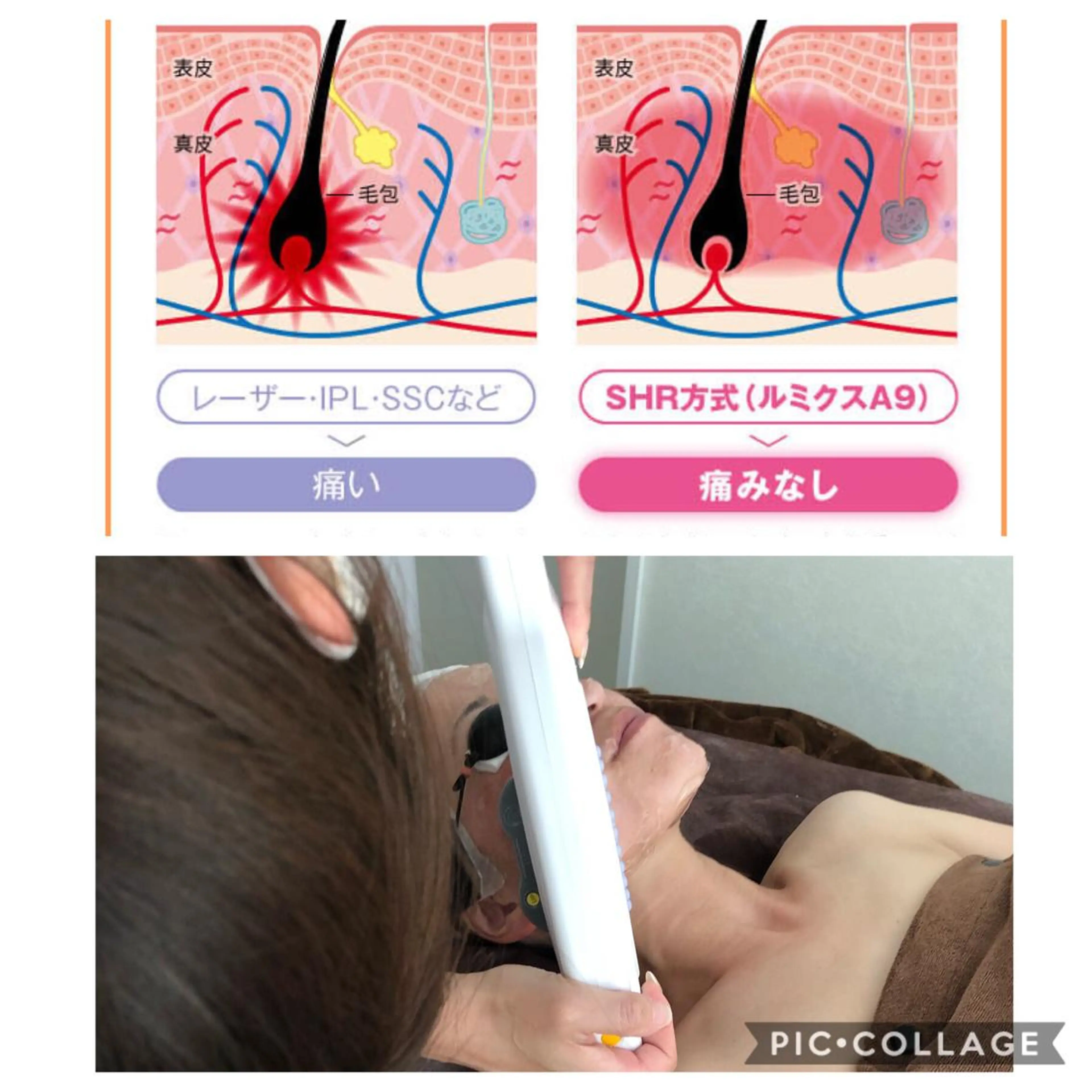 脱毛 BeautySalonGemmy所属・Gemmy 愛美のエステ・リラクイメージ