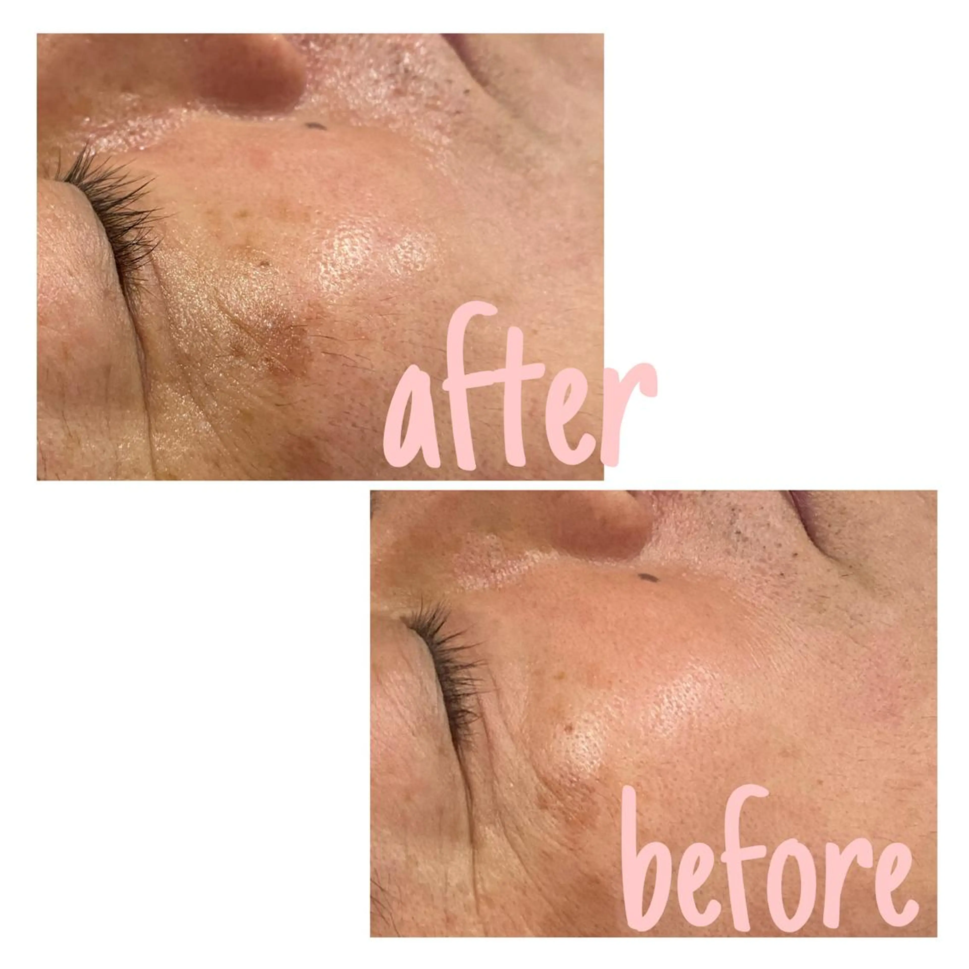 アルカンジュ~archange~所属・痩身/毛穴洗浄/脱毛 アルカンジュのエステ・リラクイメージ