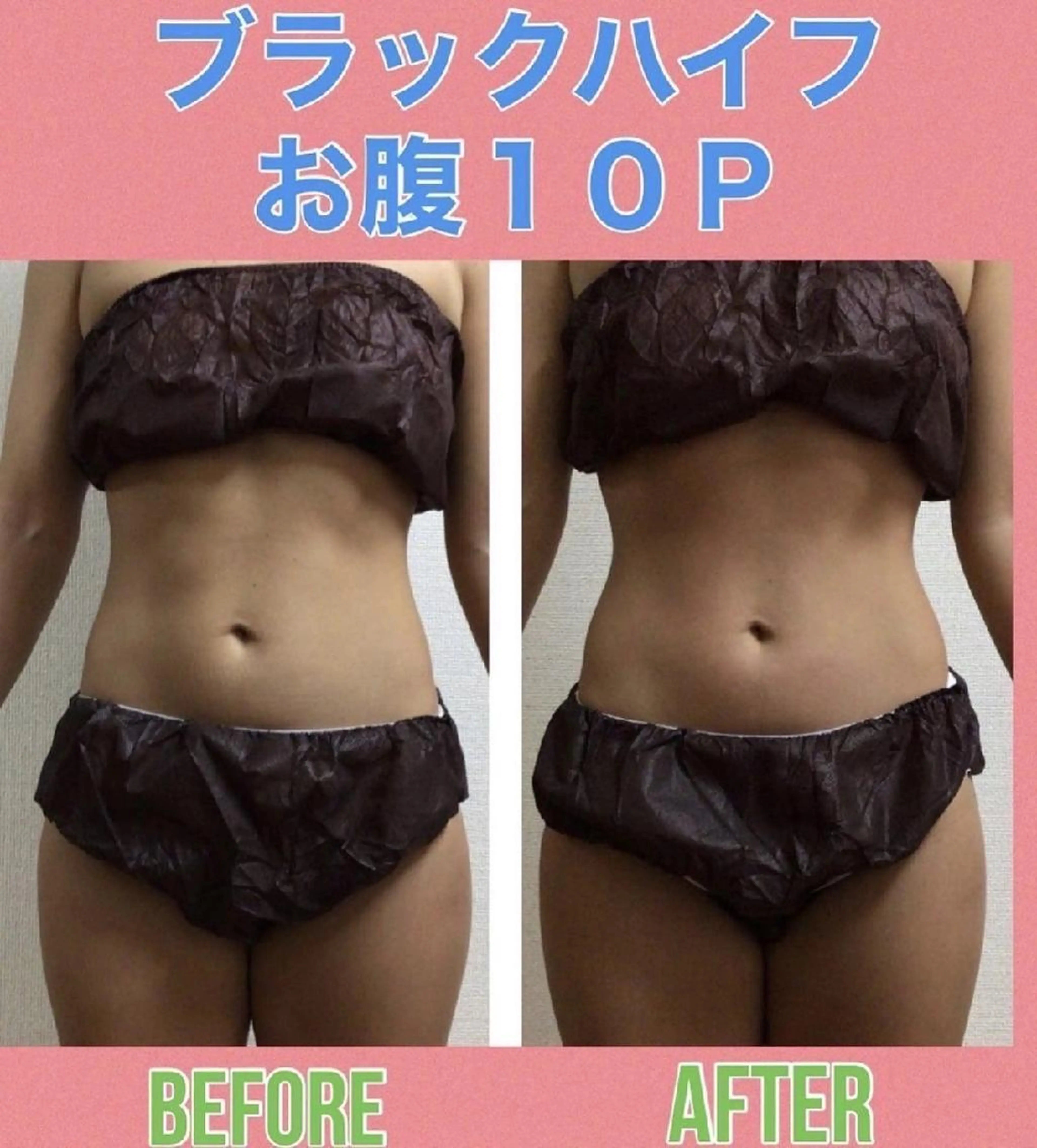 エステ Re, Luxのエステ・リラクイメージ