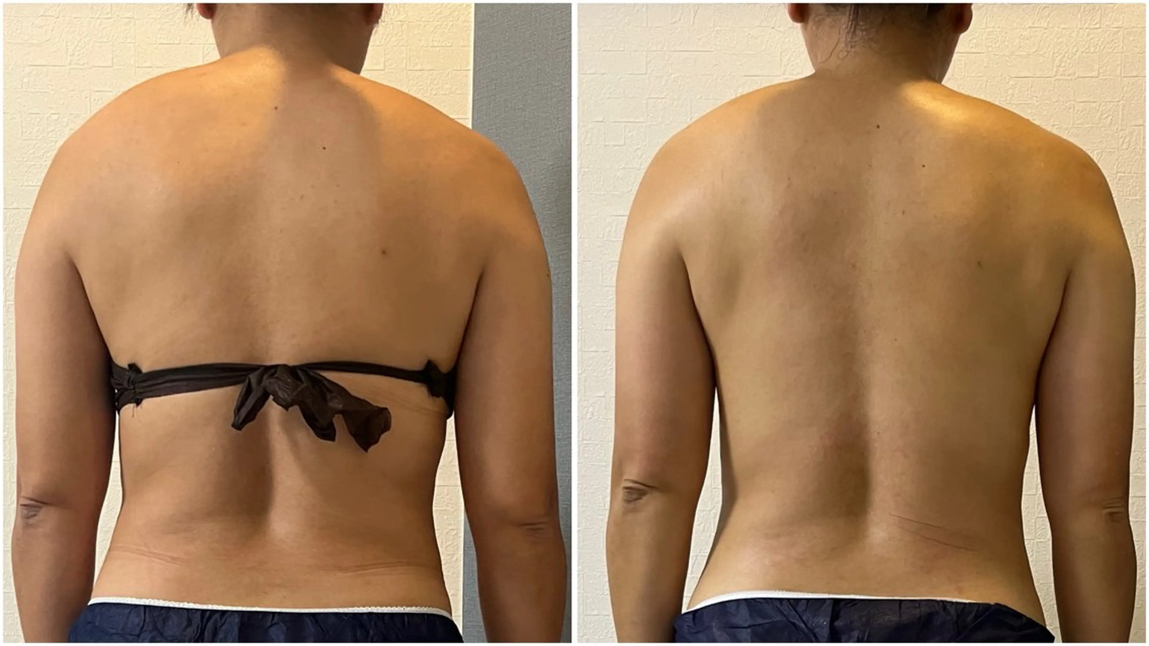 湘南エステサロン moaのエステ・リラクイメージ