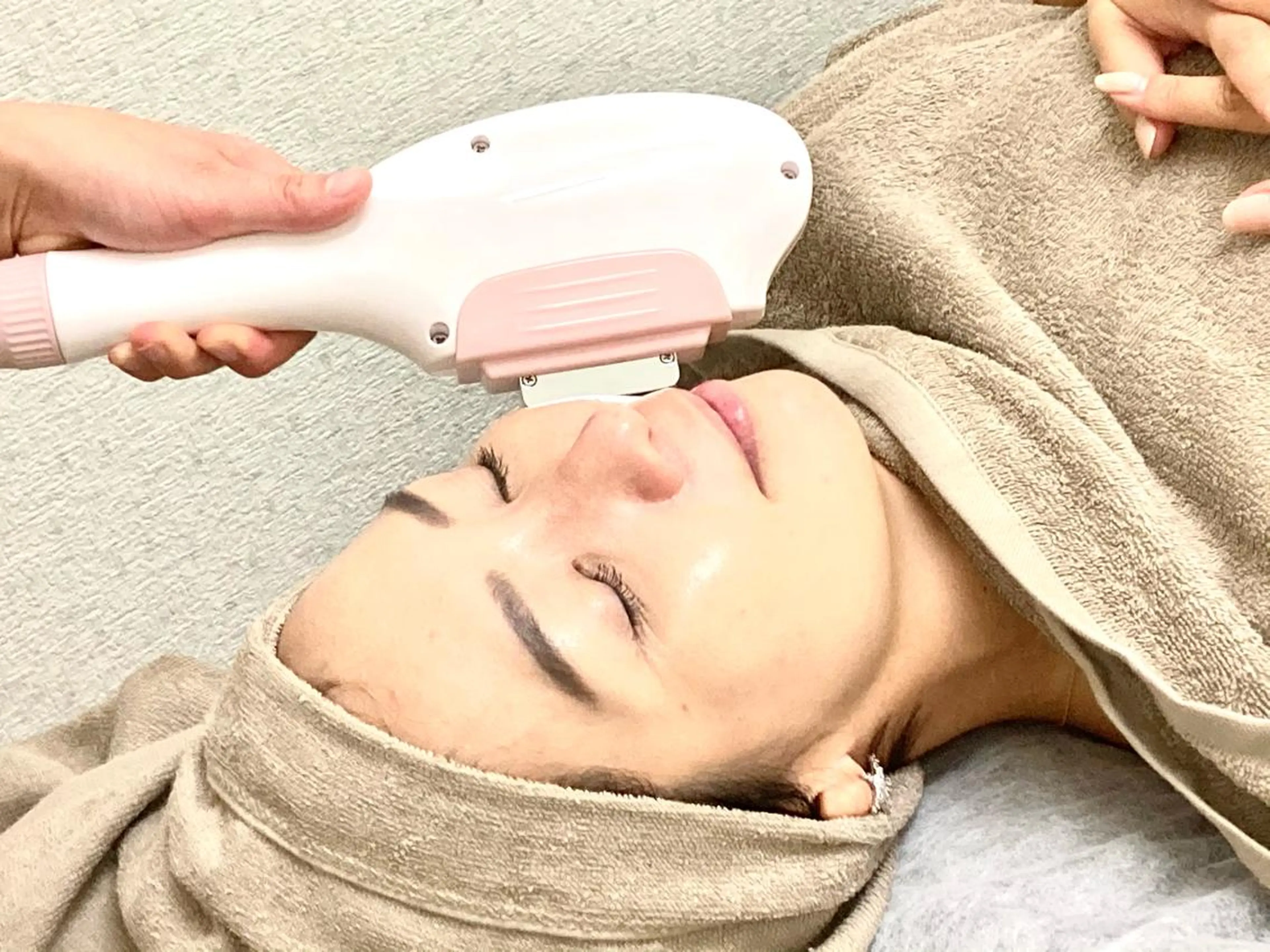 【女性限定】顔まるごと脱毛✨¥4000→¥2000🎉産毛を徹底除去して毛穴の黒ずみ&引き締めにも❤️の写真