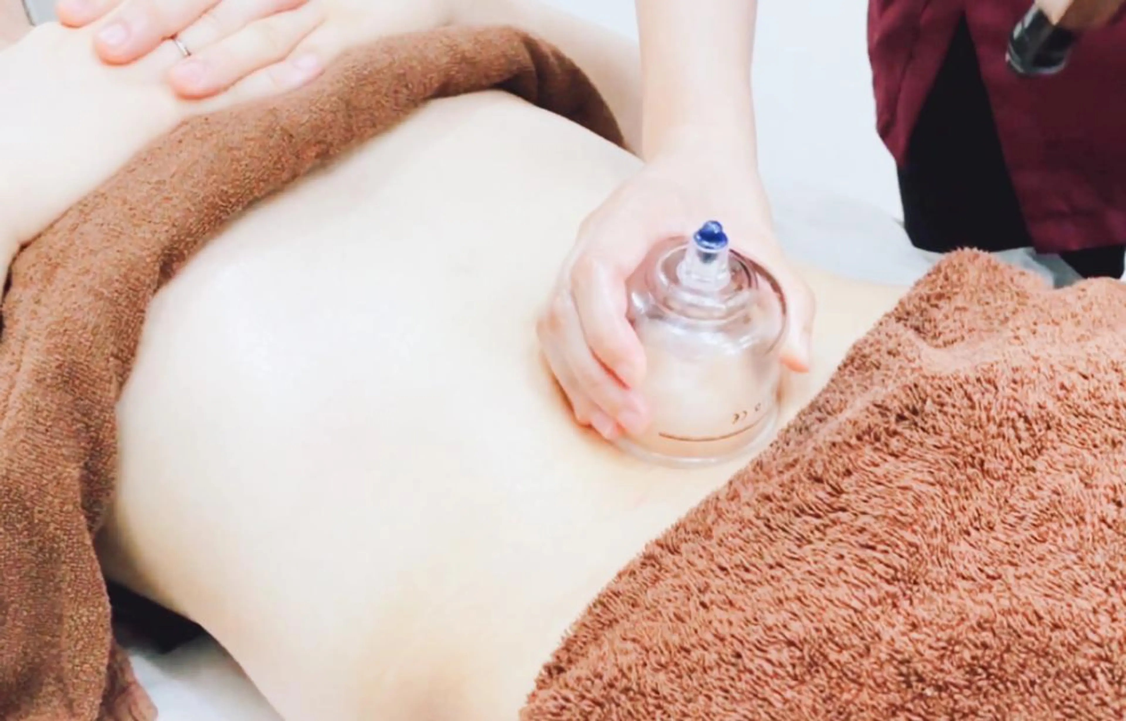 その他 【美容鍼・小顔鍼】 鍼灸師　吉田洋美のエステ・リラクイメージ