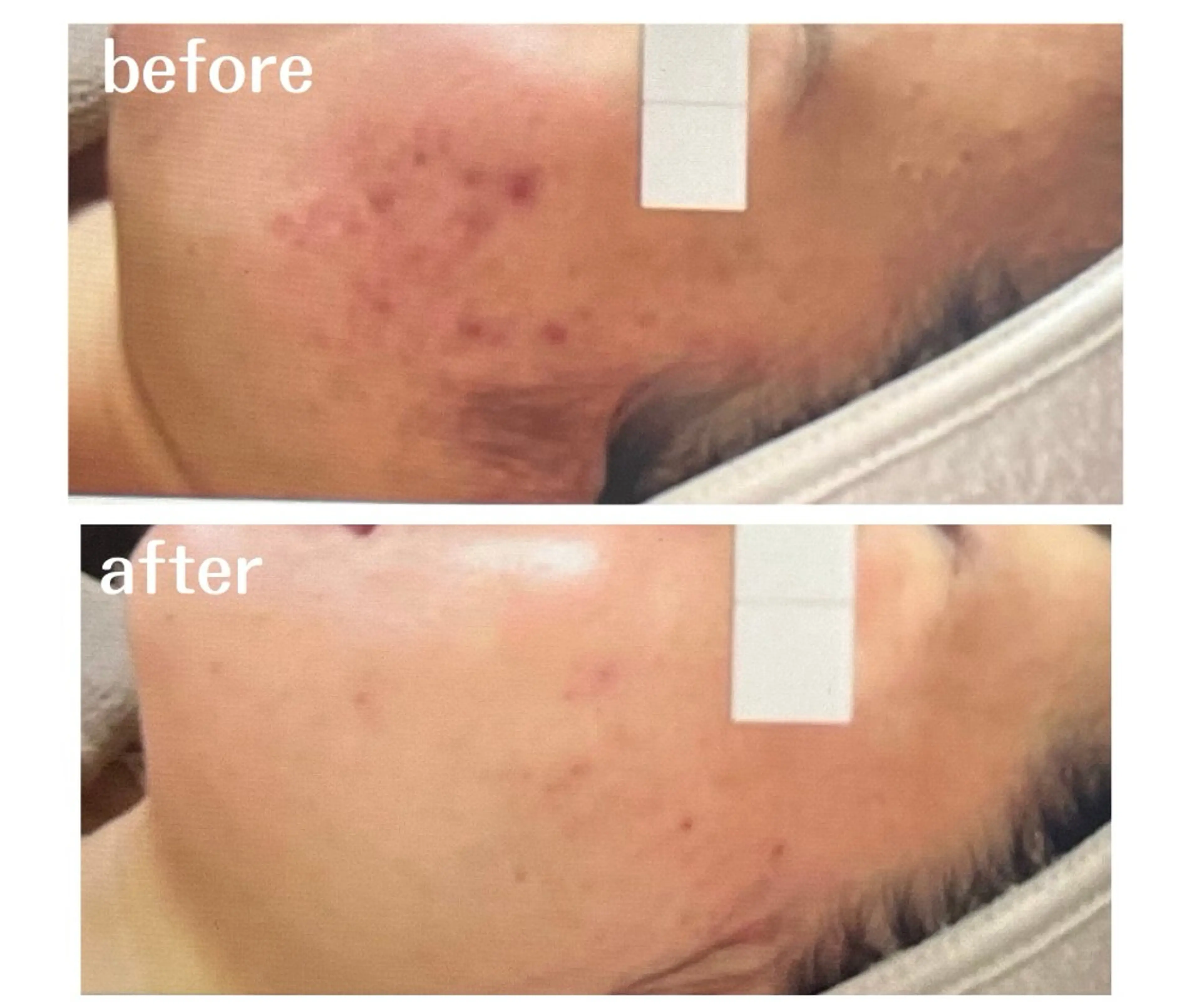 エステ aimee　肌質改善サロン【アイミー】所属・肌質改善サロン aimee｜アイミーのエステ・リラクイメージ