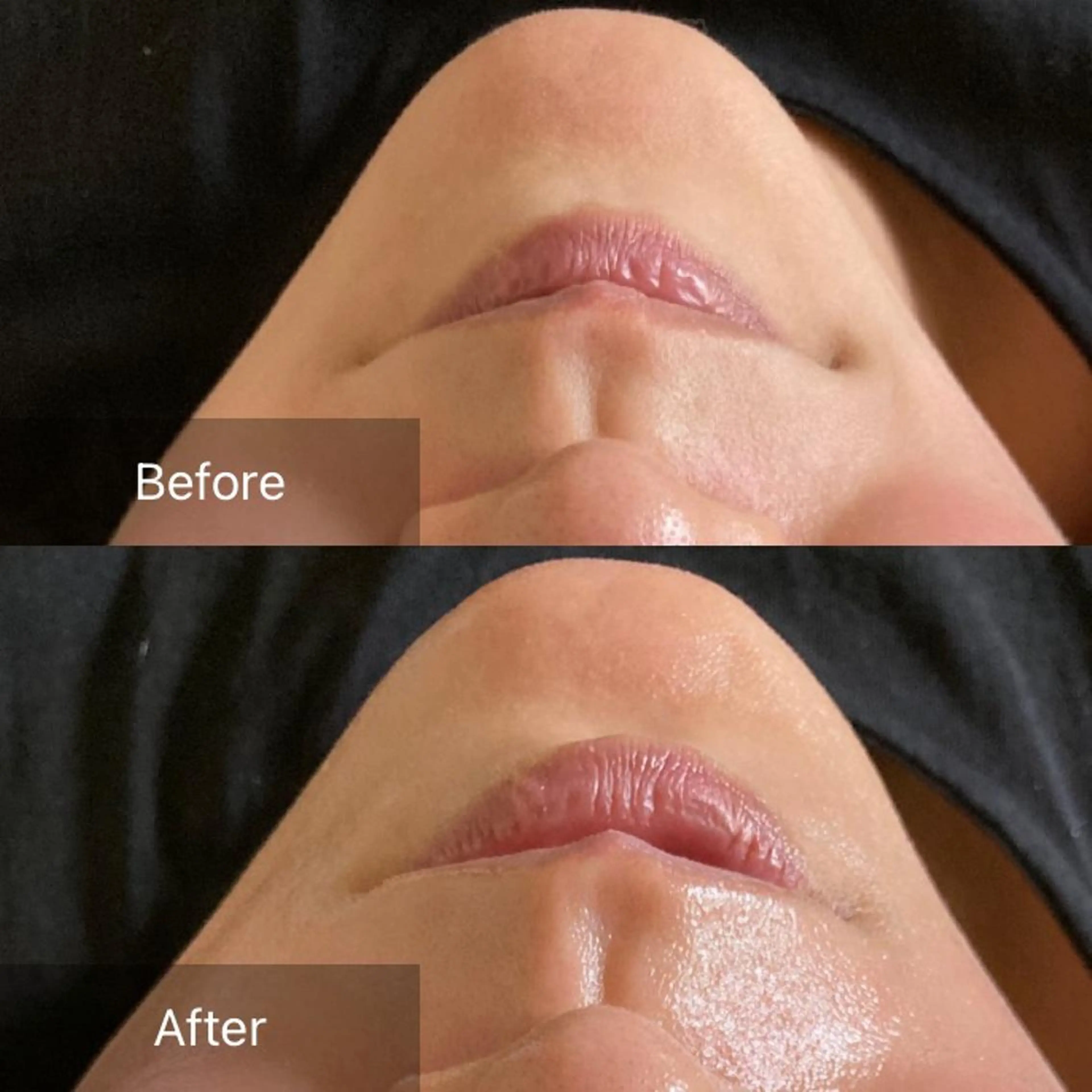 脱毛 産毛専門店 Bittoのエステ・リラクイメージ