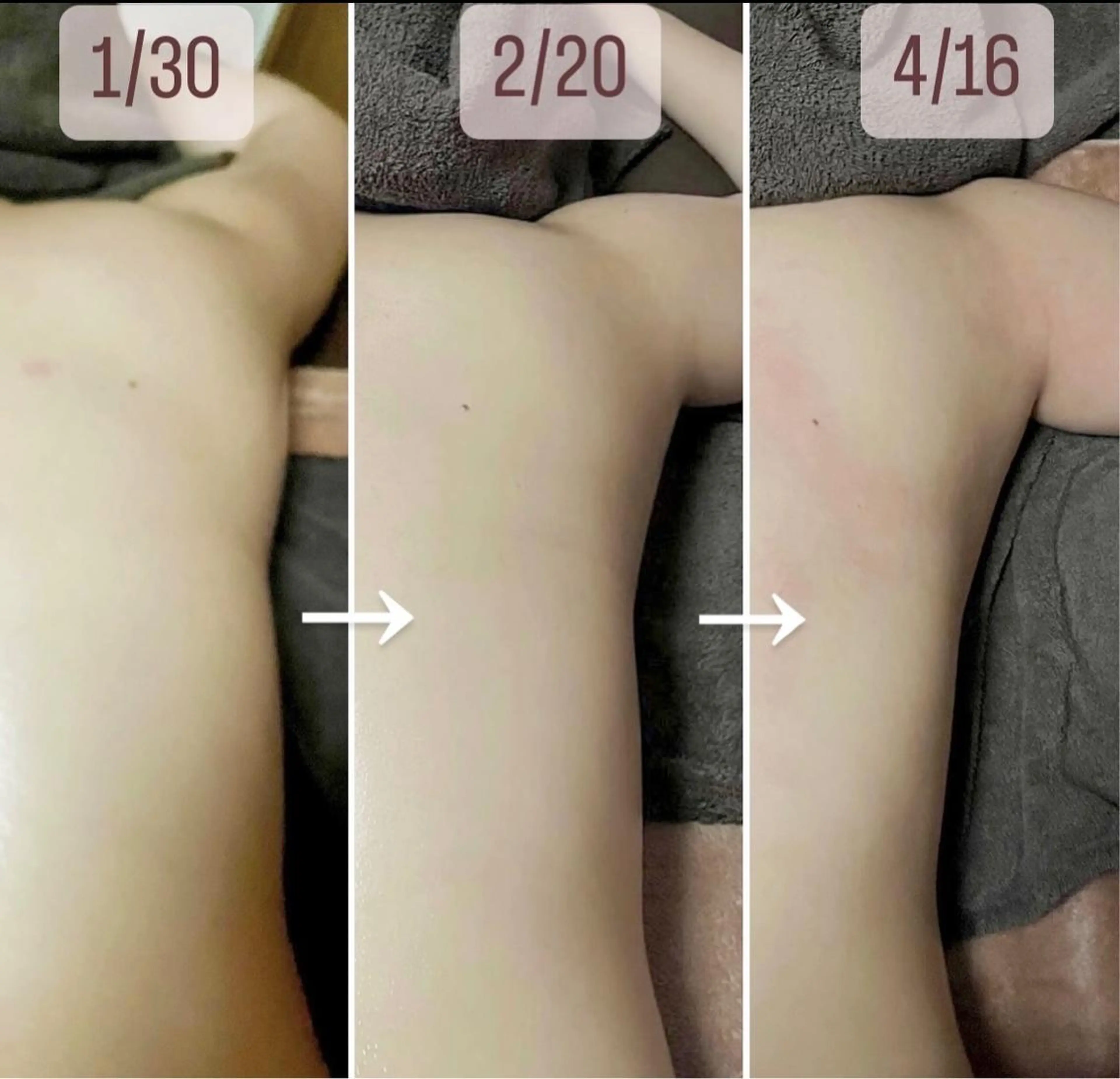 アイカワールド所属・鈴木 愛加のエステ・リラクイメージ